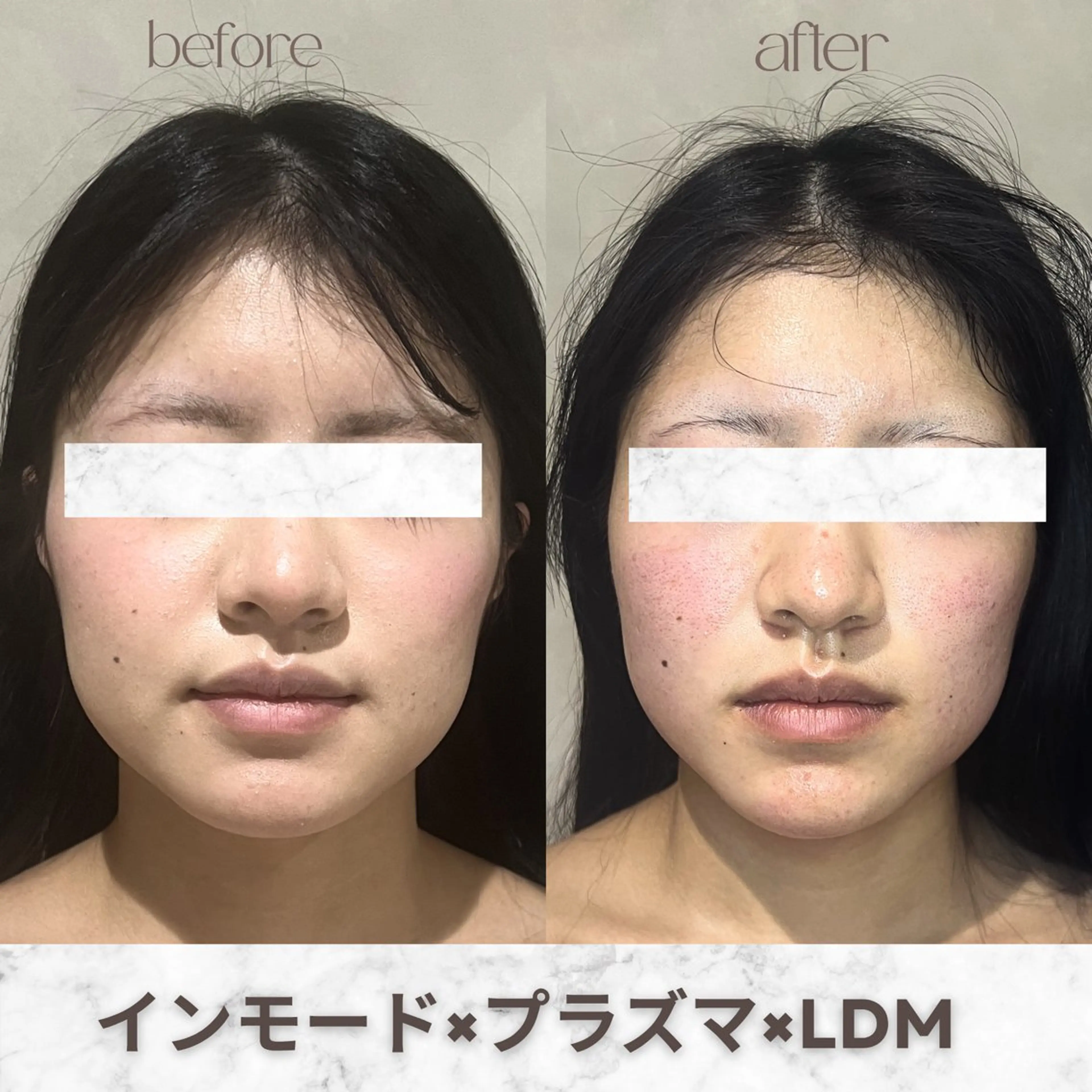 その他 aimer 服部のその他イメージ