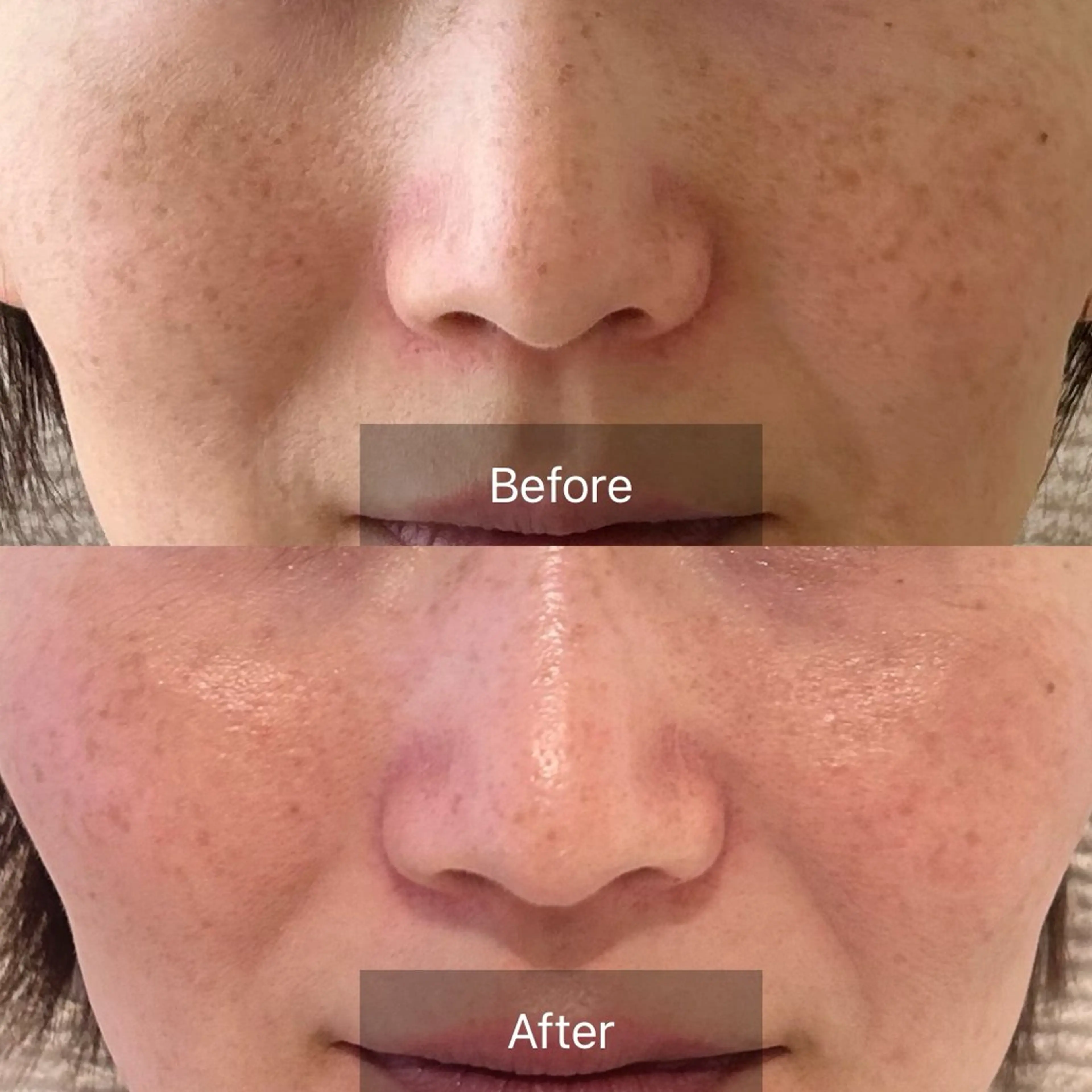 Charis エステ&ネイルのエステ・リラクイメージ