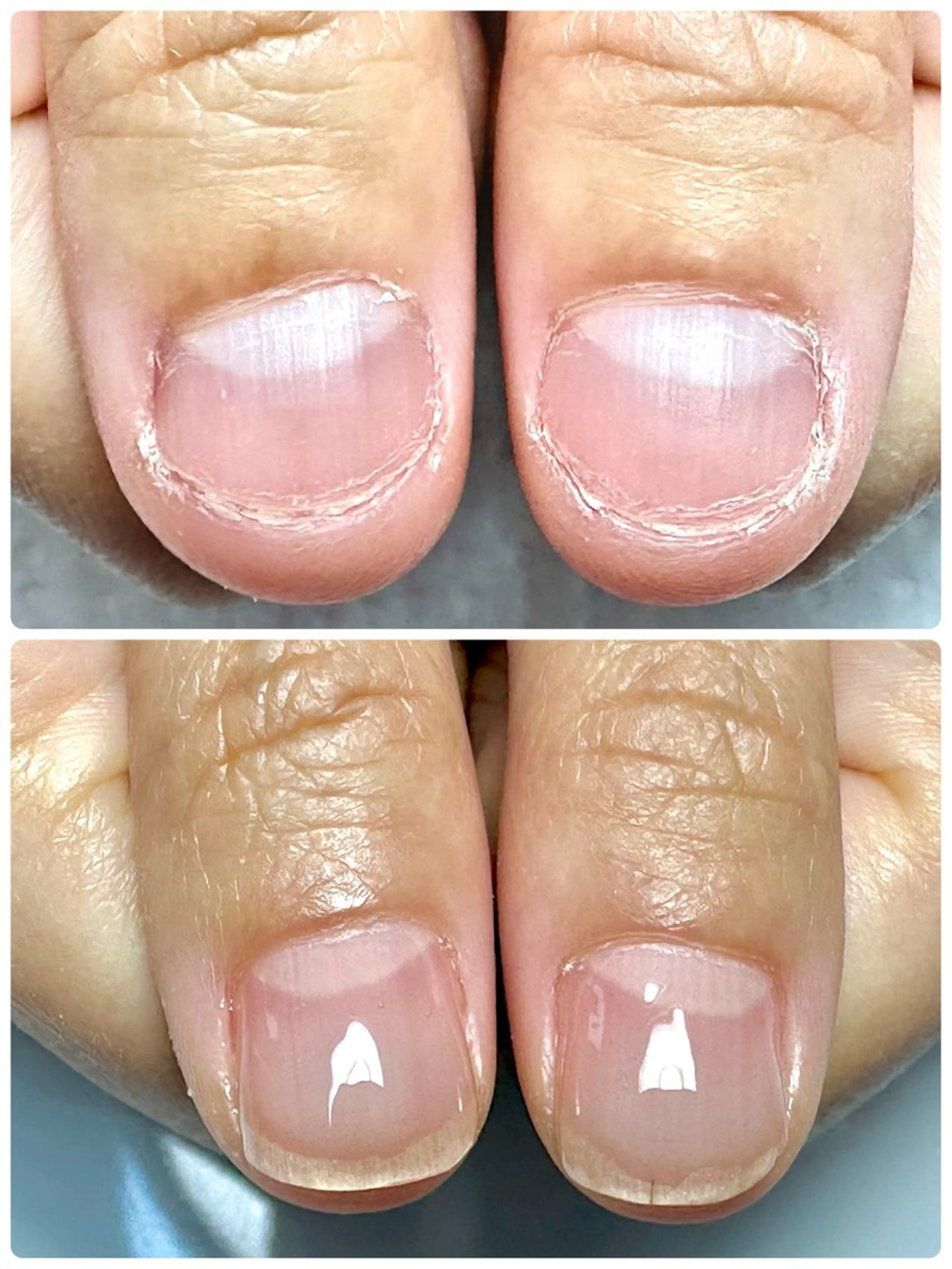 ネイル 自爪育成サロン ラムールのネイルデザイン