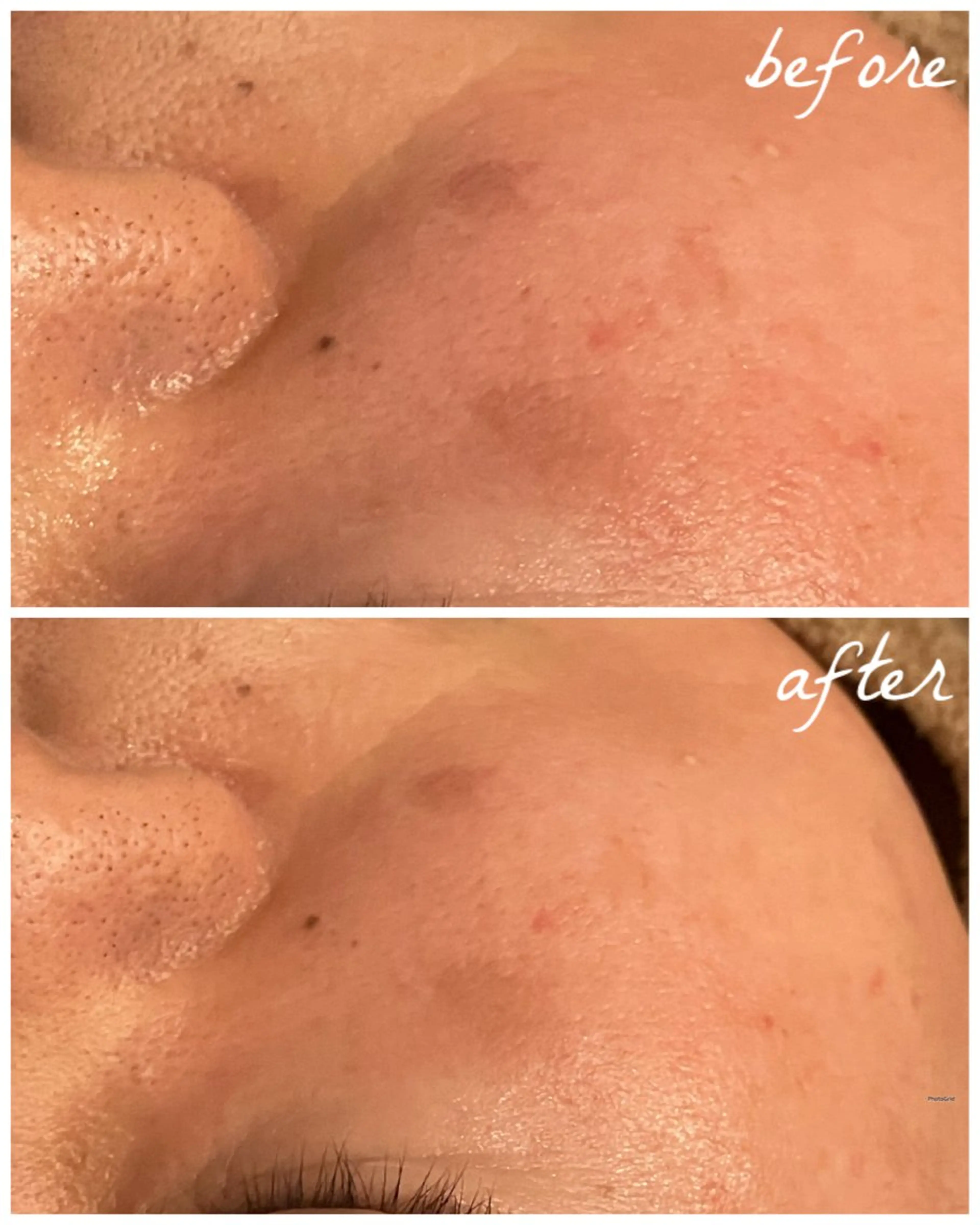 メンズ エステ メナード岐阜茜部 杉浦のエステ・リラクイメージ