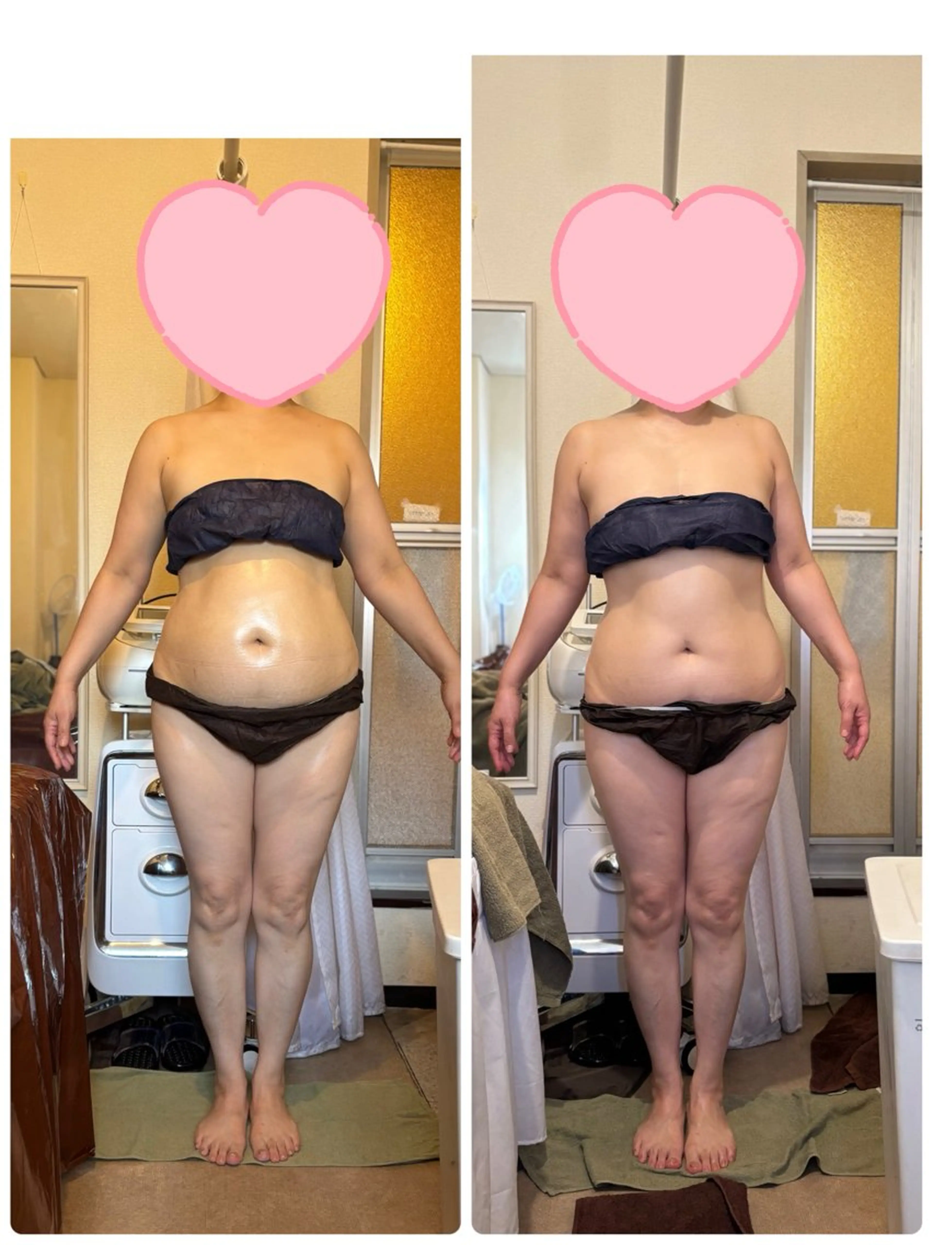 ホスファチジルコリン配合オイルリンパケア（60キロ​〜​80キロまで）コースの写真