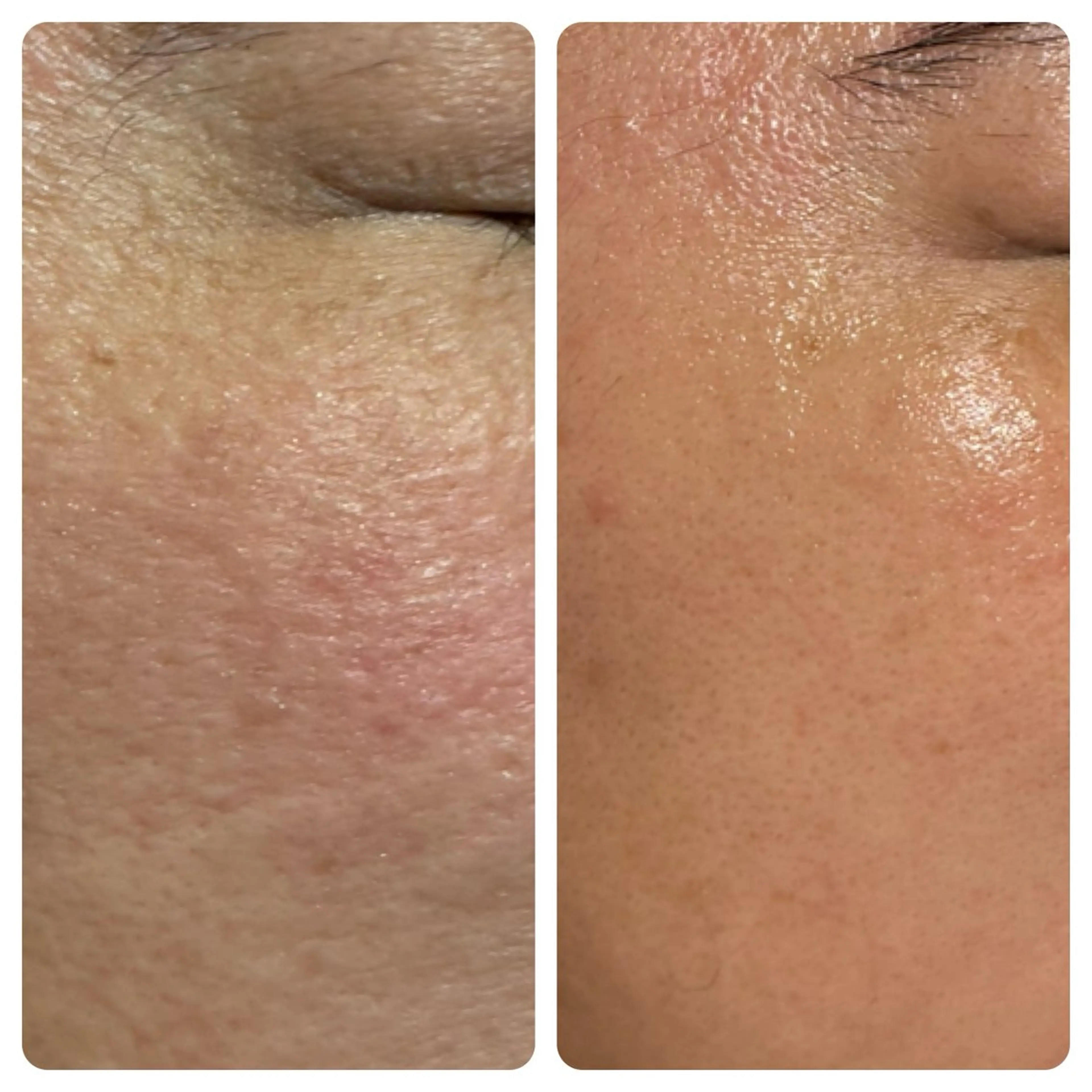 FLORALNOTE所属・ReCell 肌管理のエステ・リラクイメージ