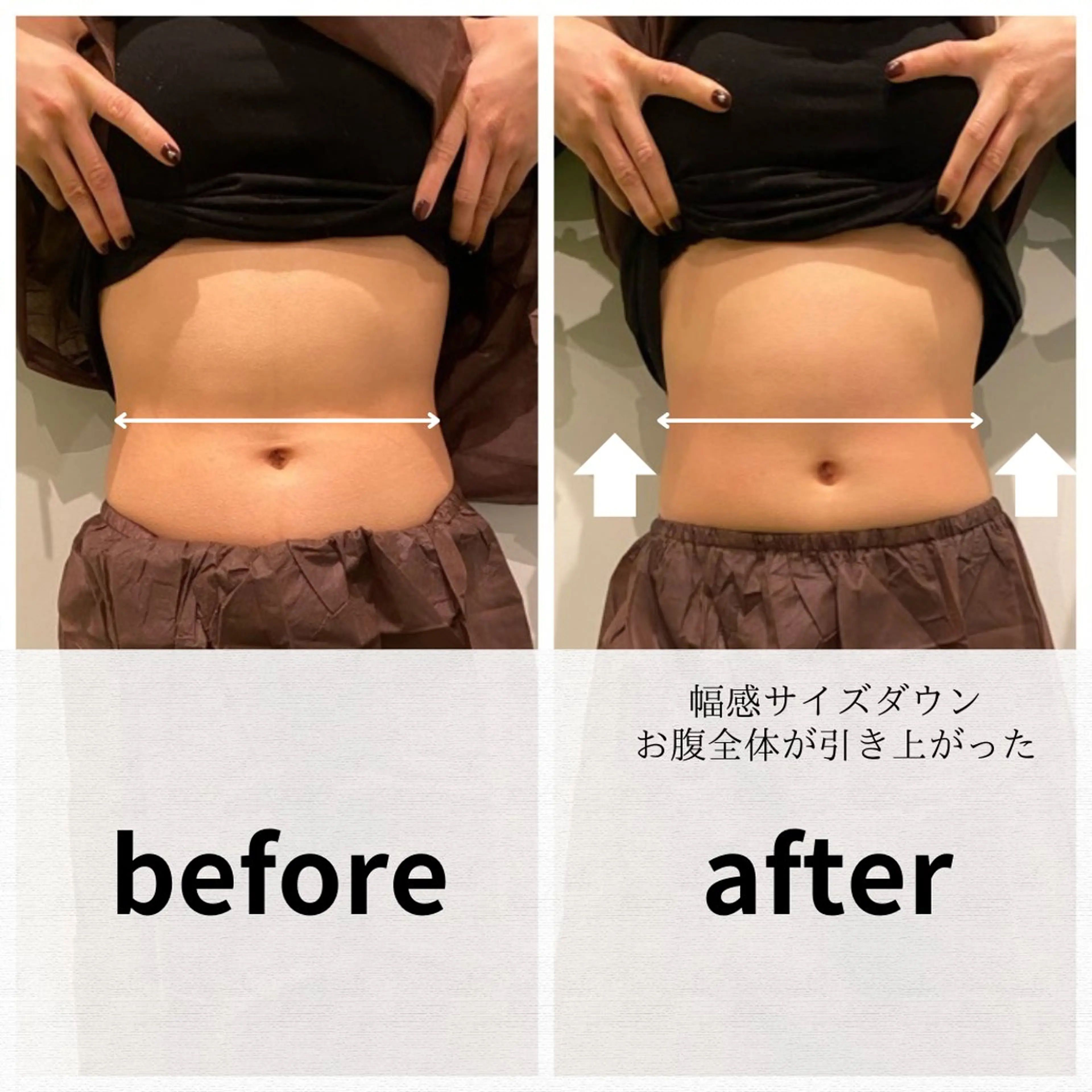 美容鍼/ヘッドスパ/ 💎さかもとのエステ・リラクイメージ