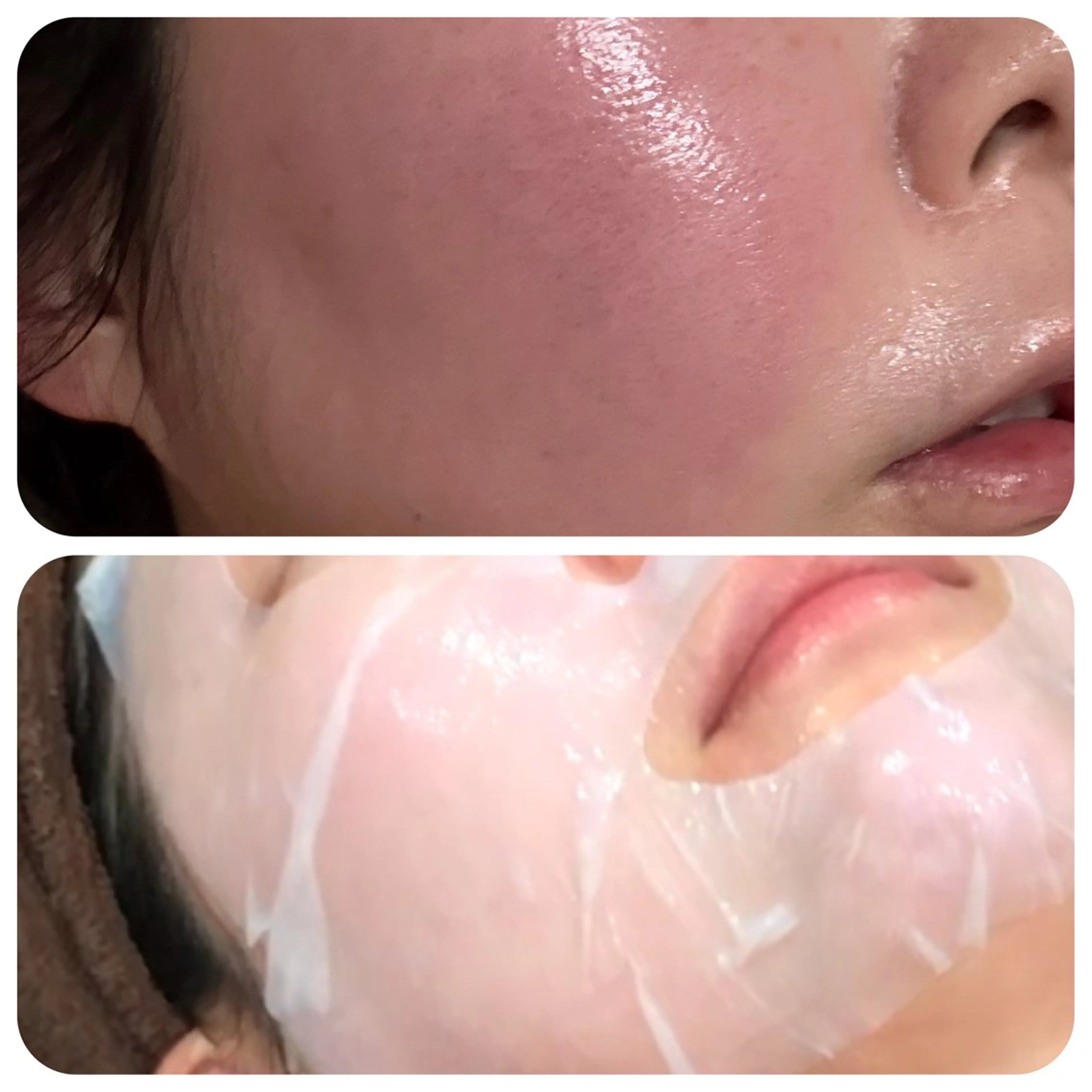 ファーストグリーンピール1day《強い肌荒れ、赤ら顔、火照り、ニキビが気になるお肌に》の写真