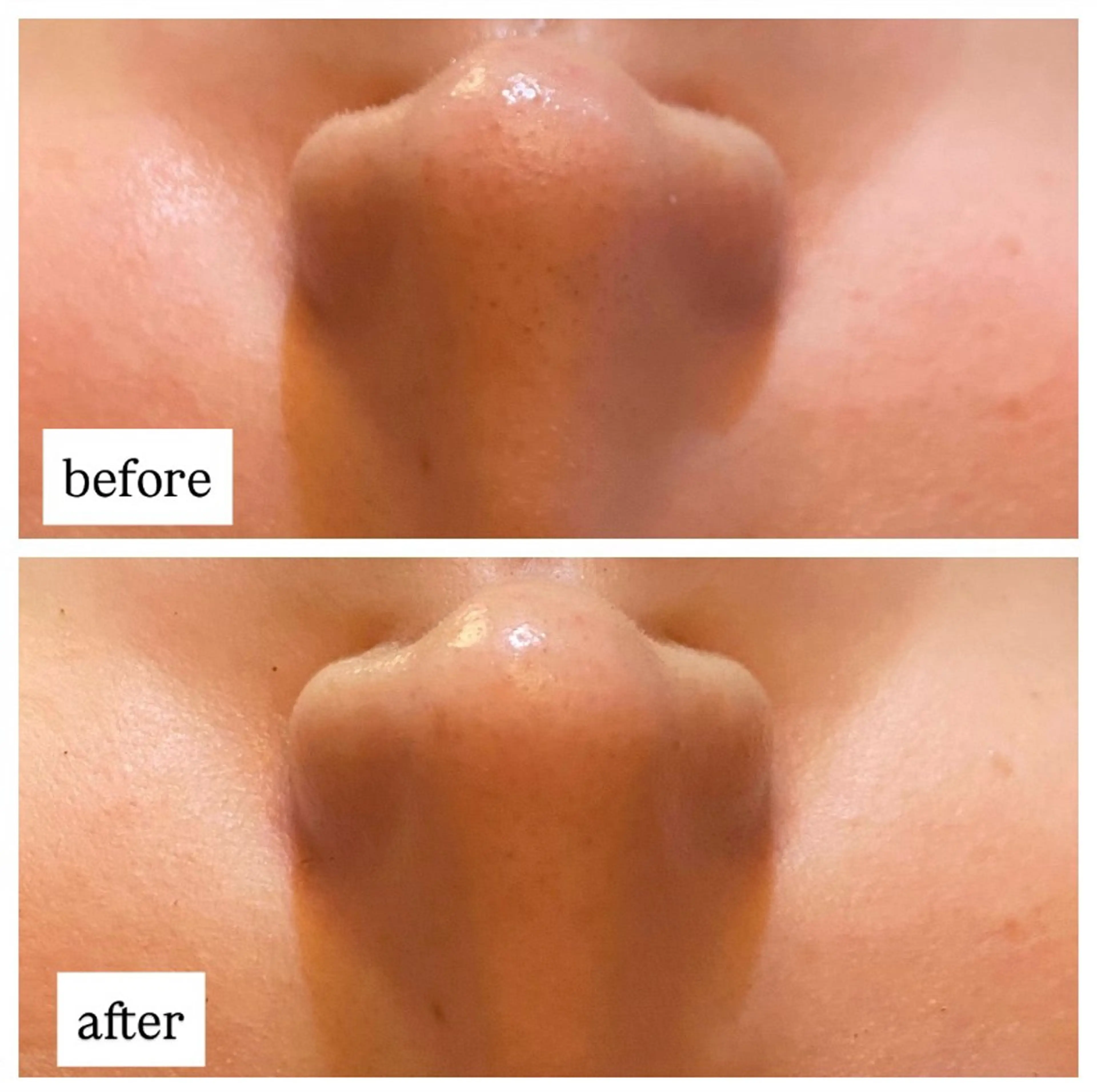 エステ 肌質改善専門 ハーブ /毛穴洗浄 リエイトのエステ・リラクイメージ