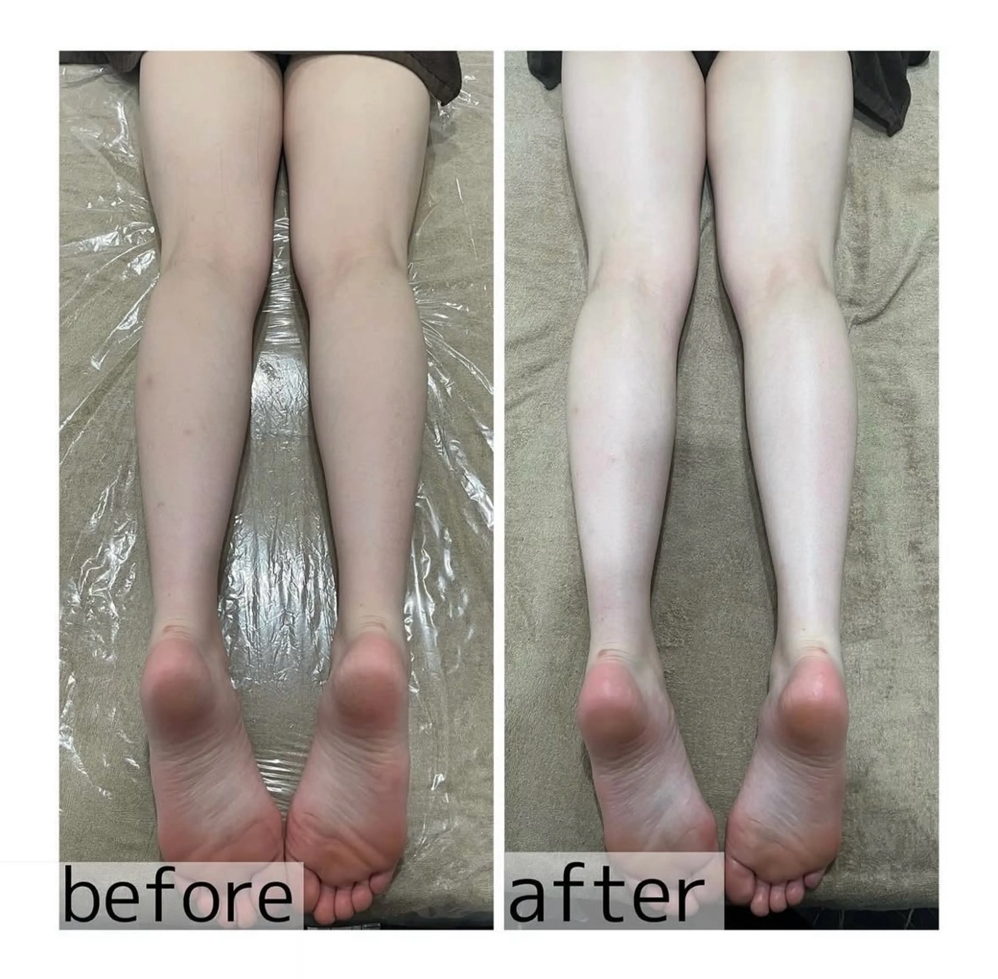 エステ リラク mimosa心斎橋所属・山﨑 諒のエステ・リラクイメージ