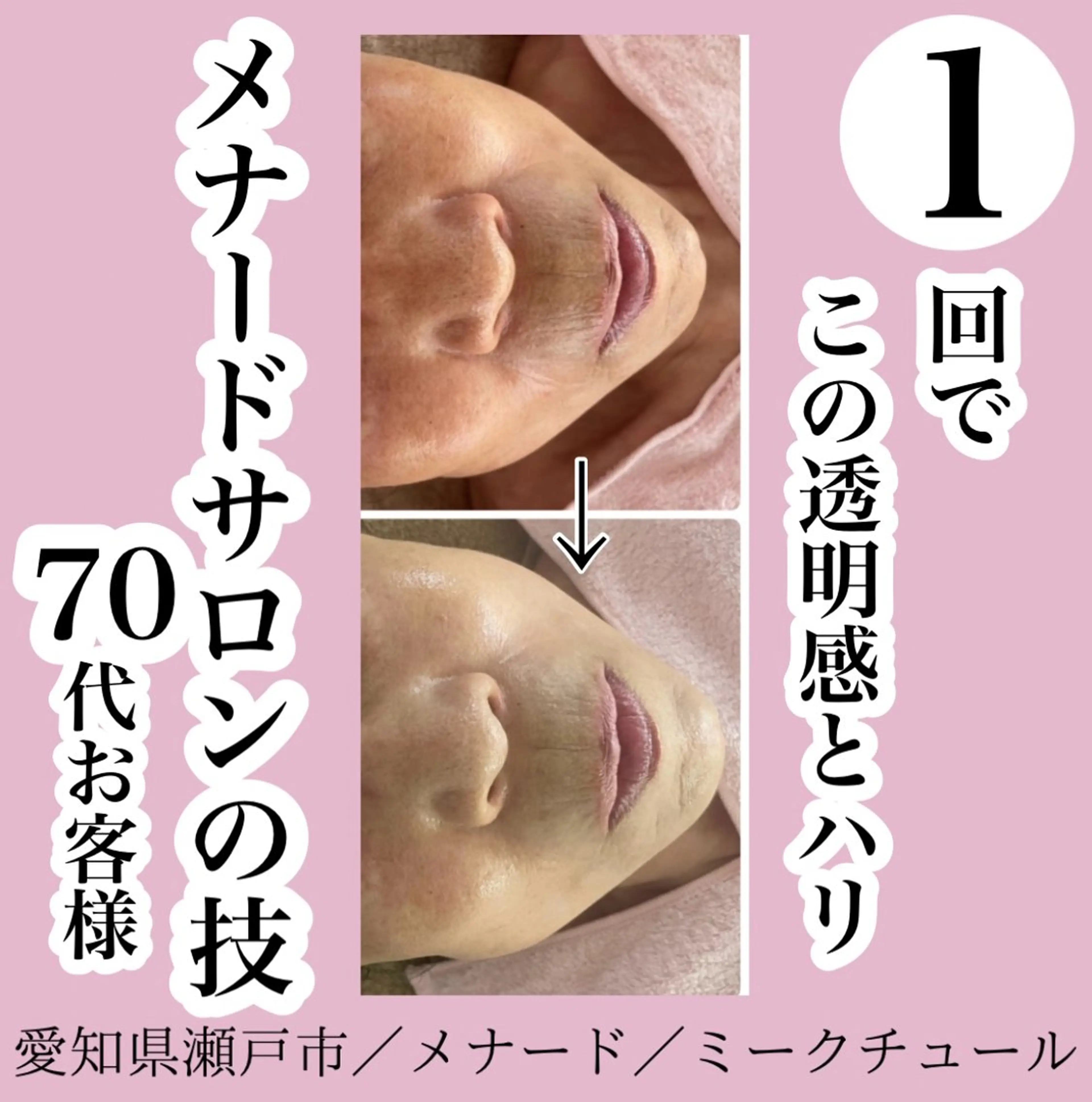 アドバンスコース＋シワ取りパック✨✨の写真