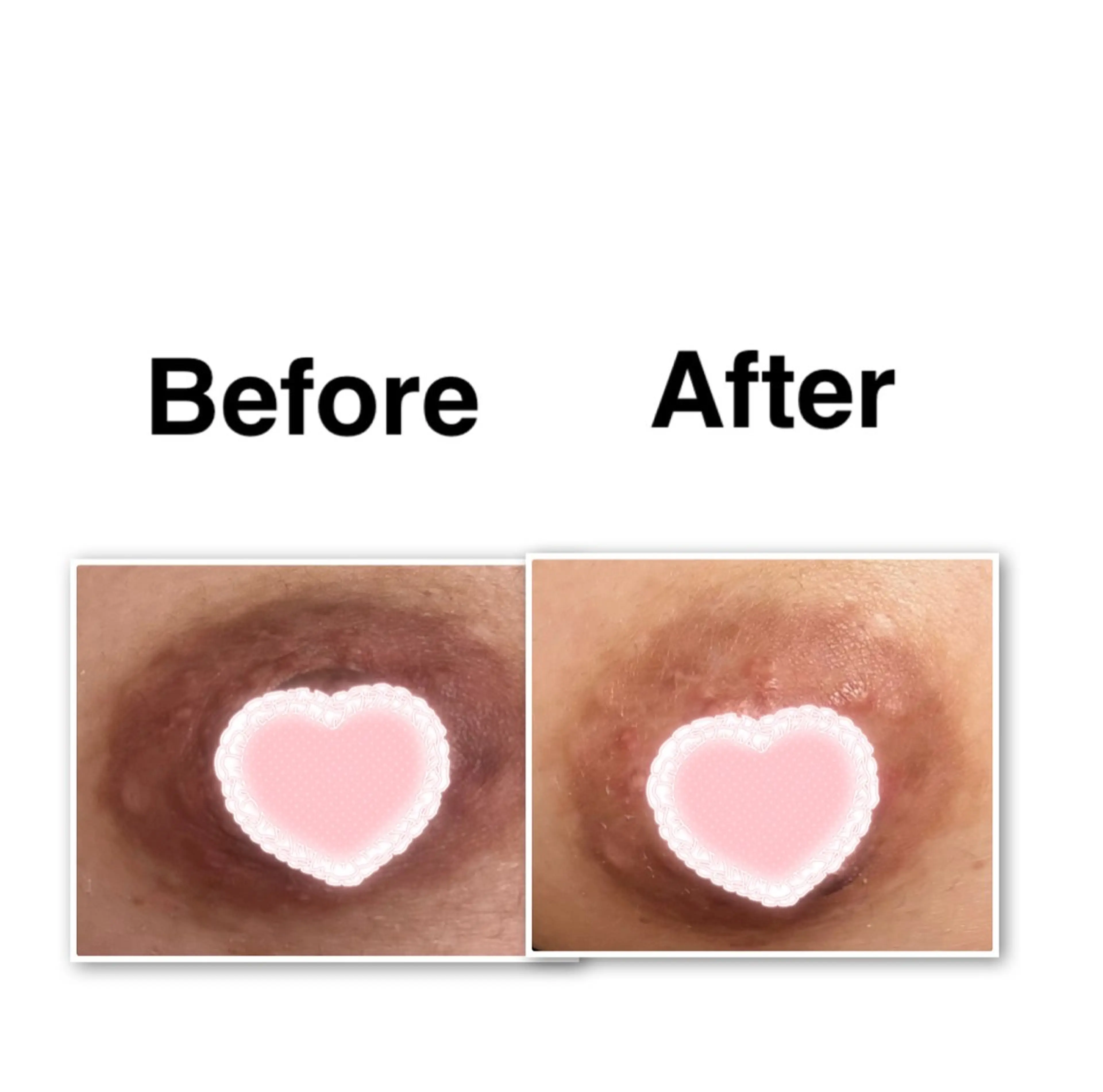 レティティア【Laetitia】所属・レティティア秋葉原店 Yoshizawaのエステ・リラクイメージ