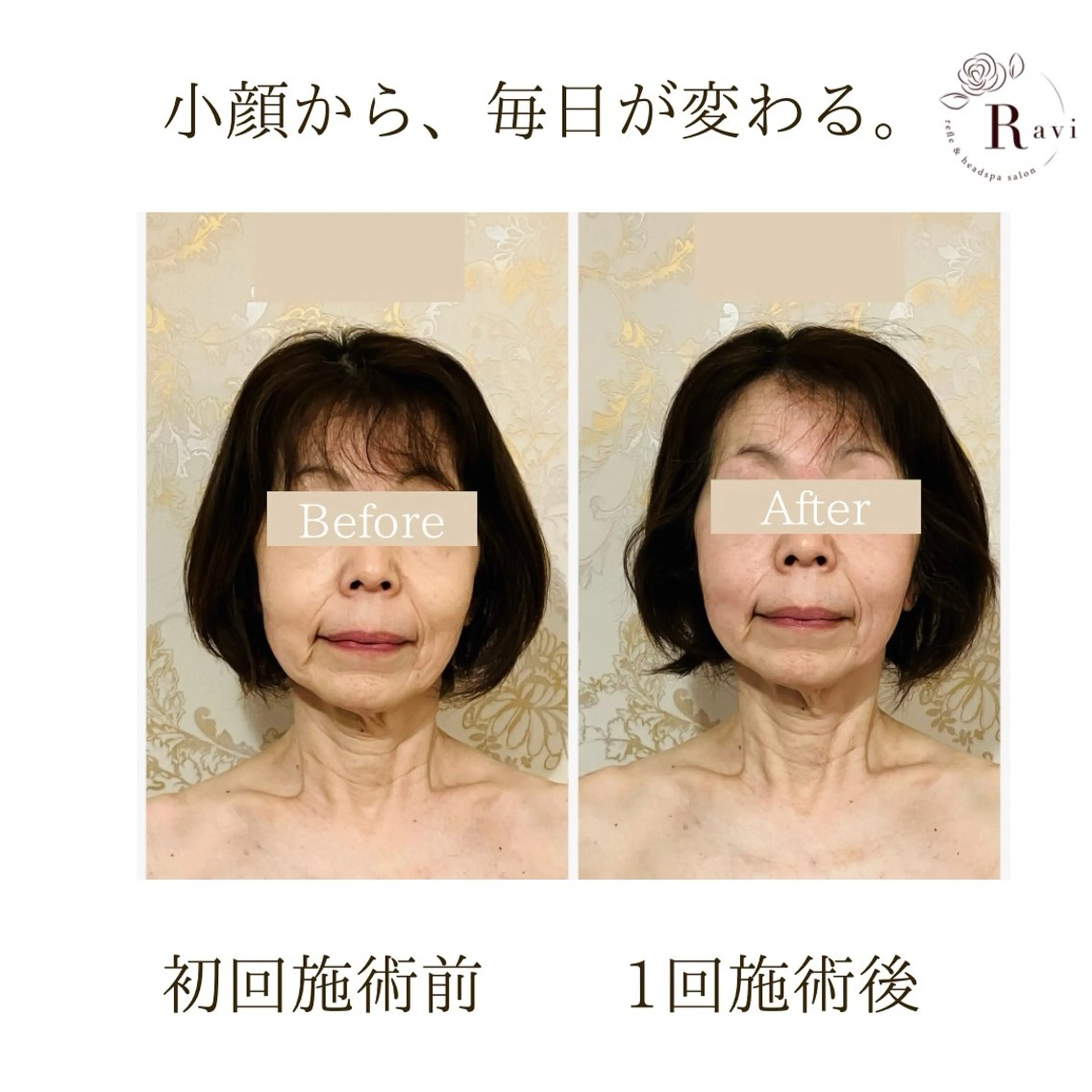 小顔サロンラヴィ　　船橋馬込沢店所属・小顔サロンラヴィ 船橋のエステ・リラクイメージ