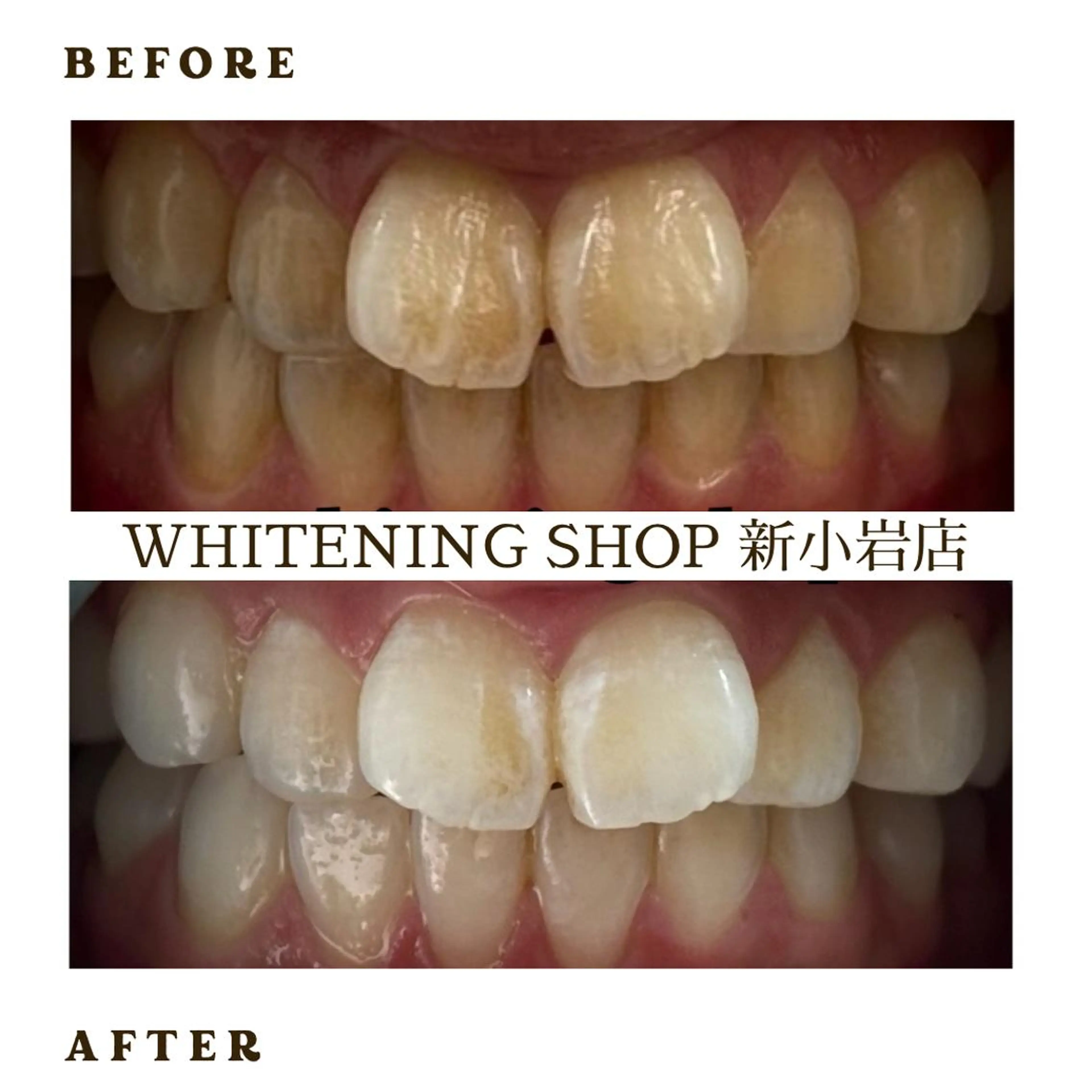 メンズ その他 ホワイトニング ショップ新小岩店のその他イメージ