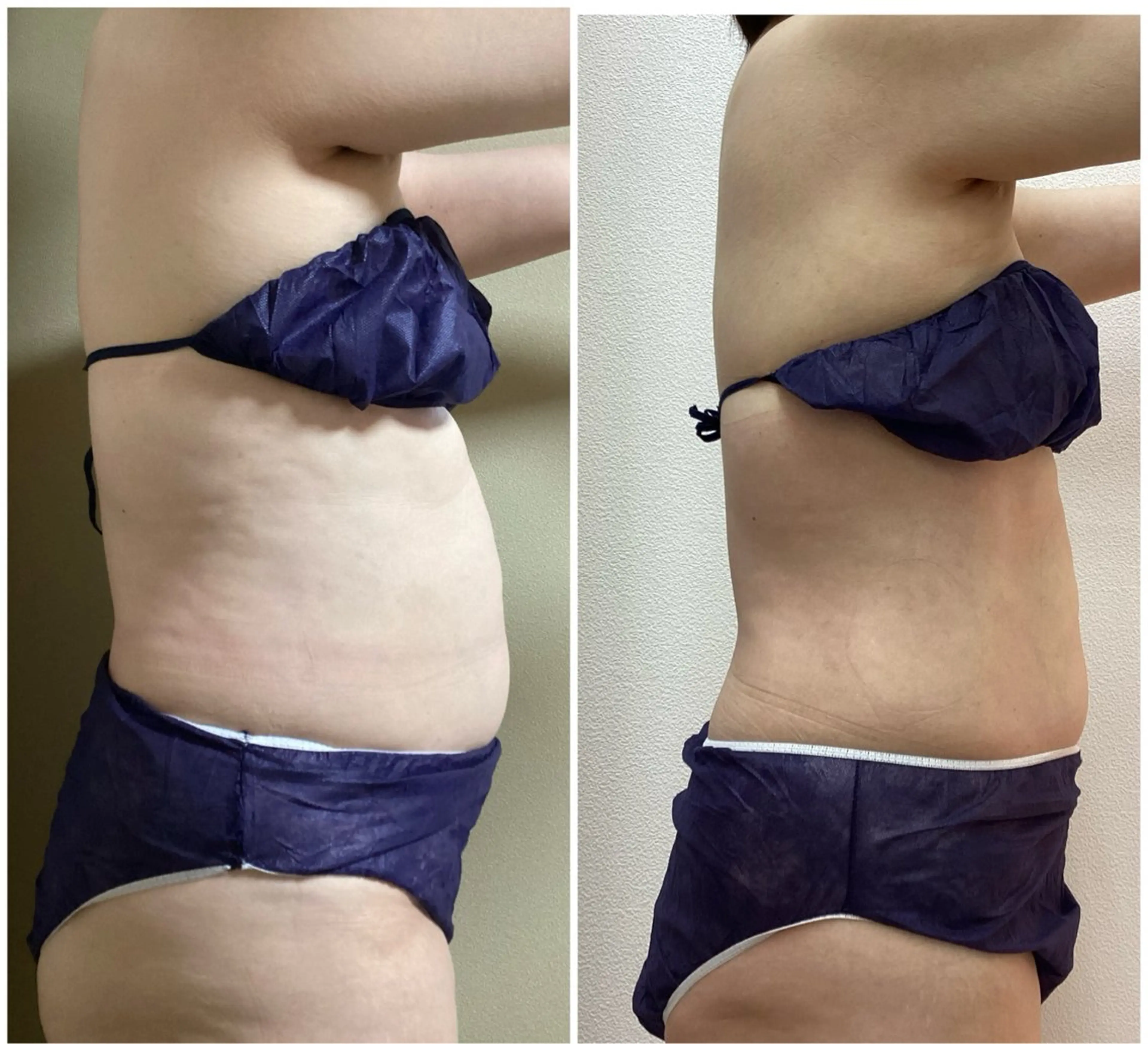 Brilliant所属・Brilliant 松原　エリカのエステ・リラクイメージ