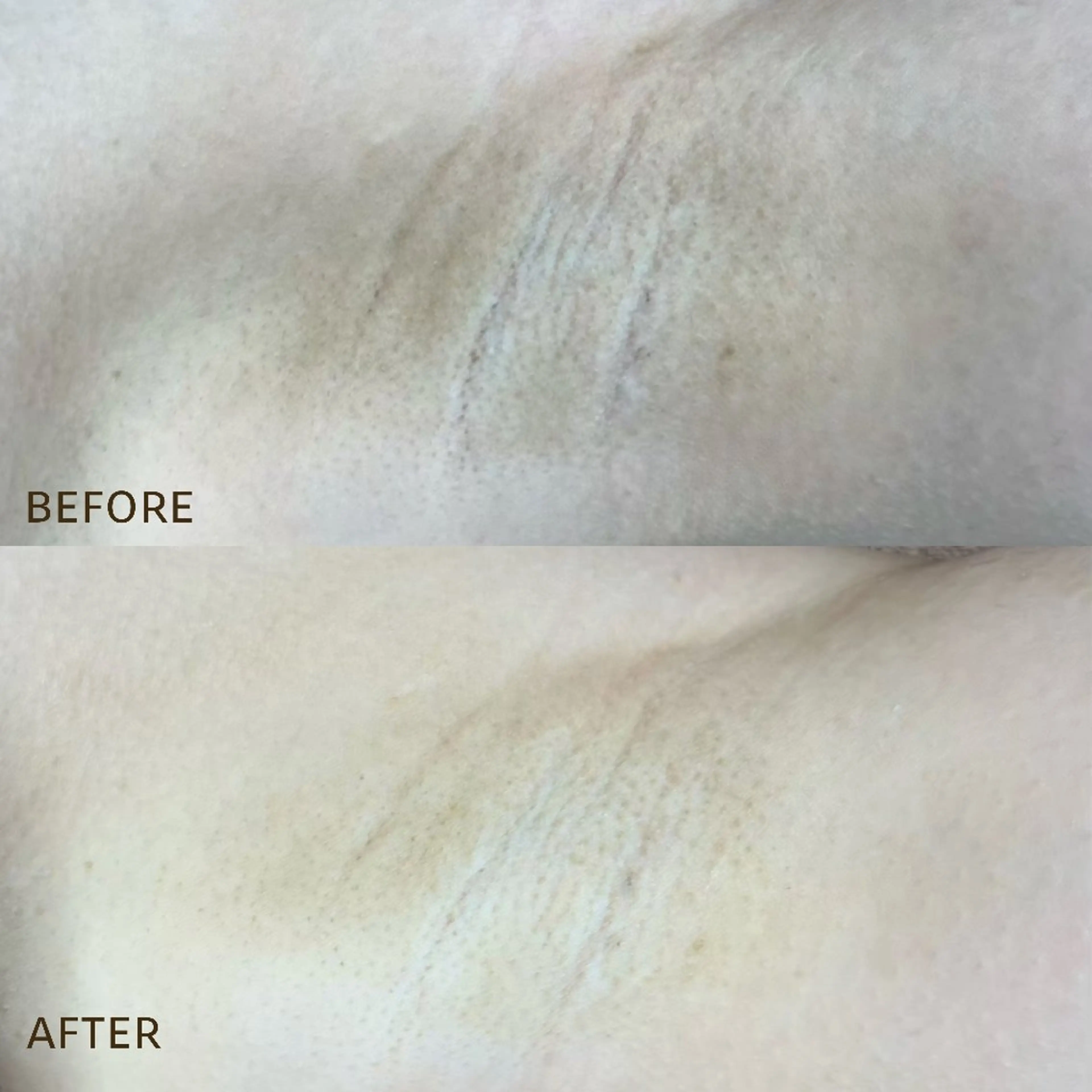 毛穴/肌管理/痩身/ ボディケア/satoのエステ・リラクイメージ