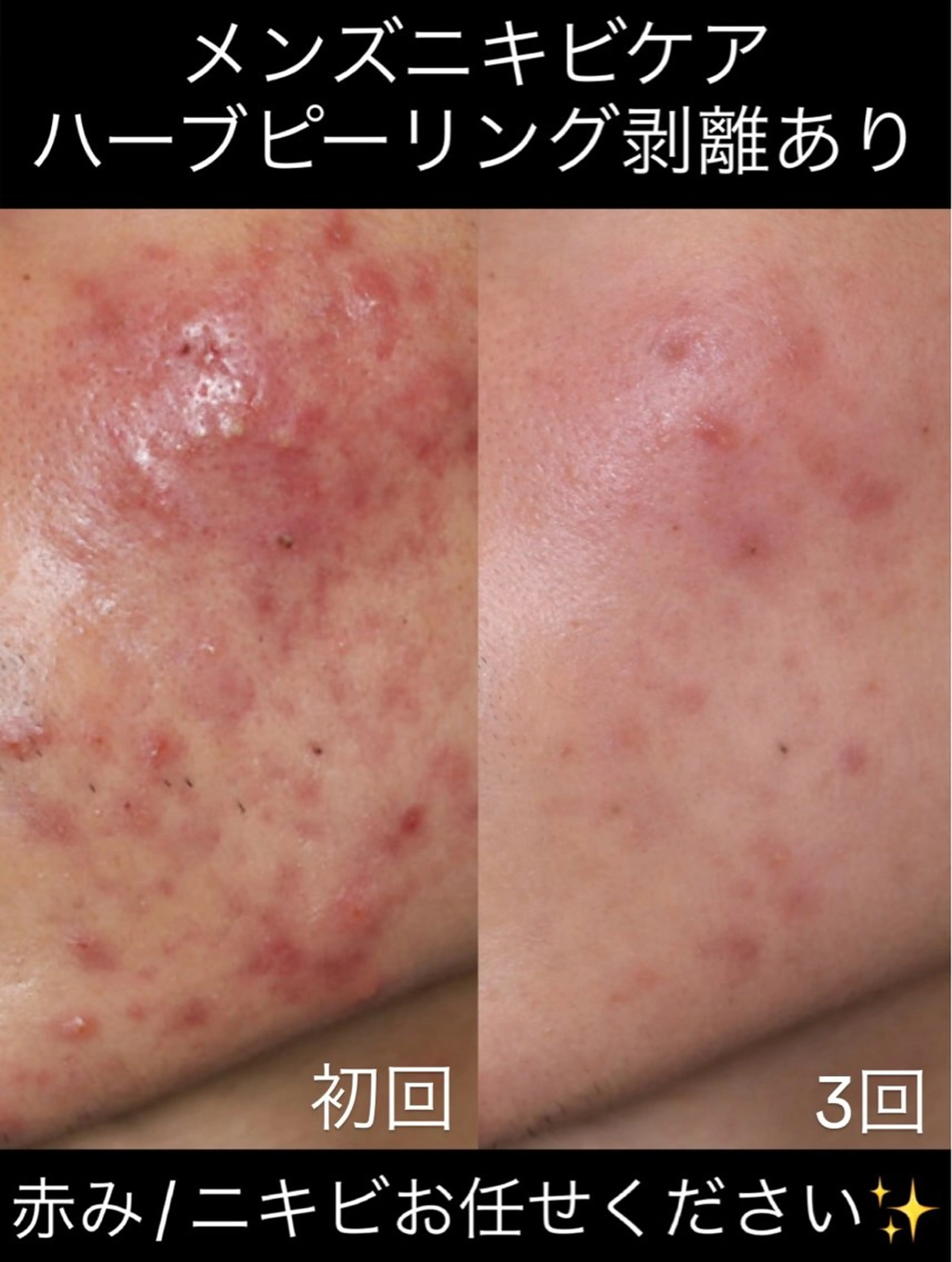 エステ Soin所属・Soin 身体＆お肌ケアのエステ・リラクイメージ