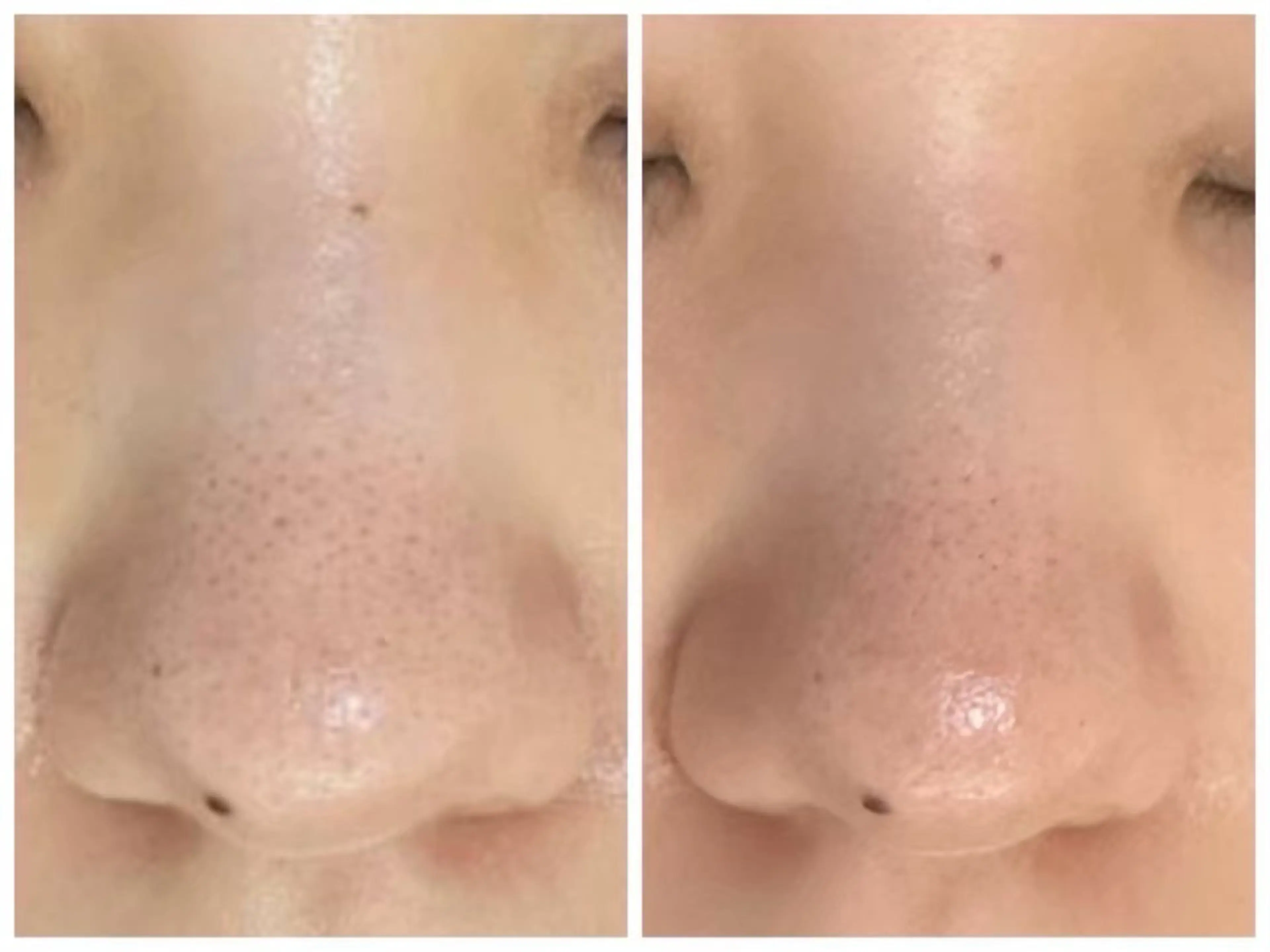 ハーブピーリング/ ララピール専門店のエステ・リラクイメージ