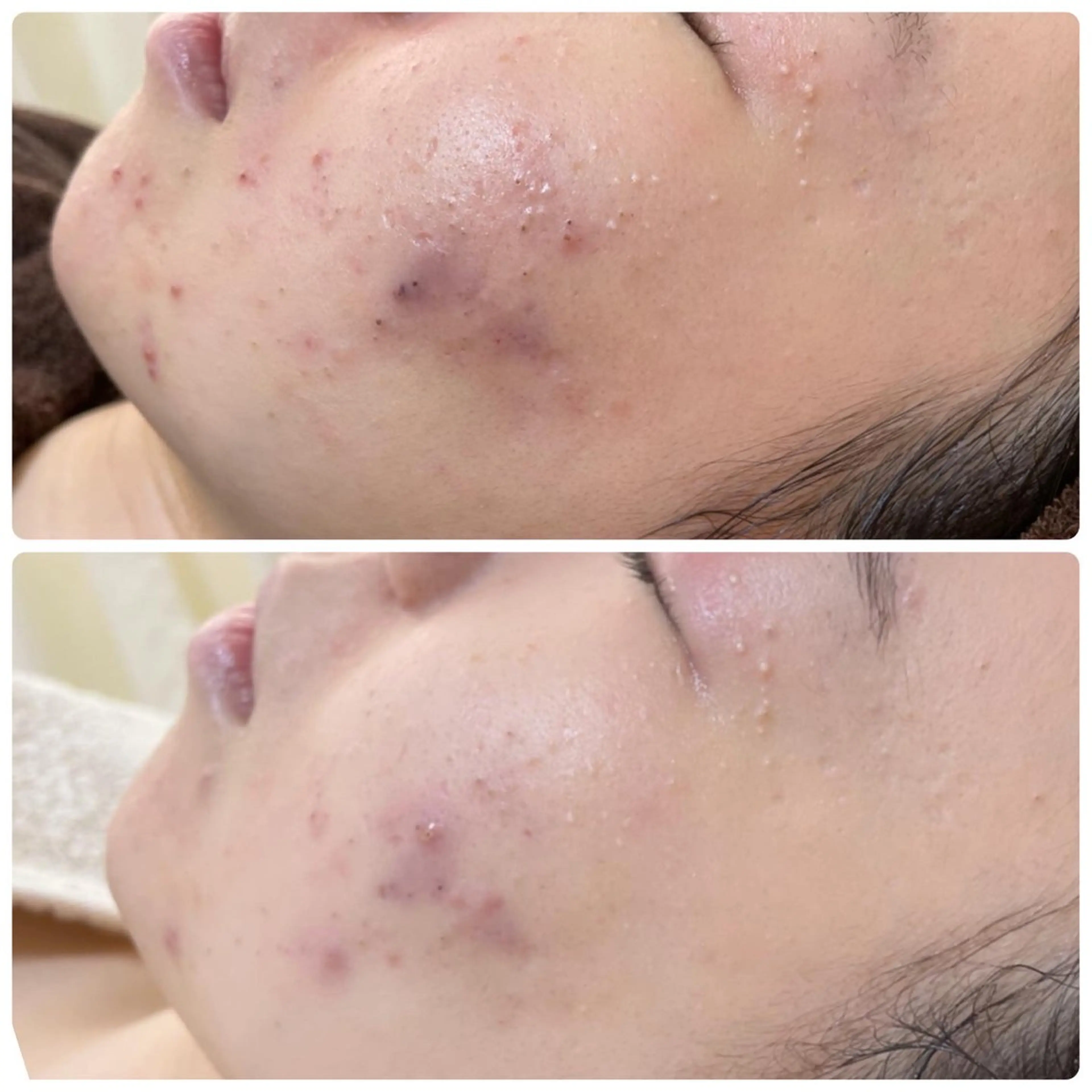 エステ 肌質改善サロン La Divinaのエステ・リラクイメージ