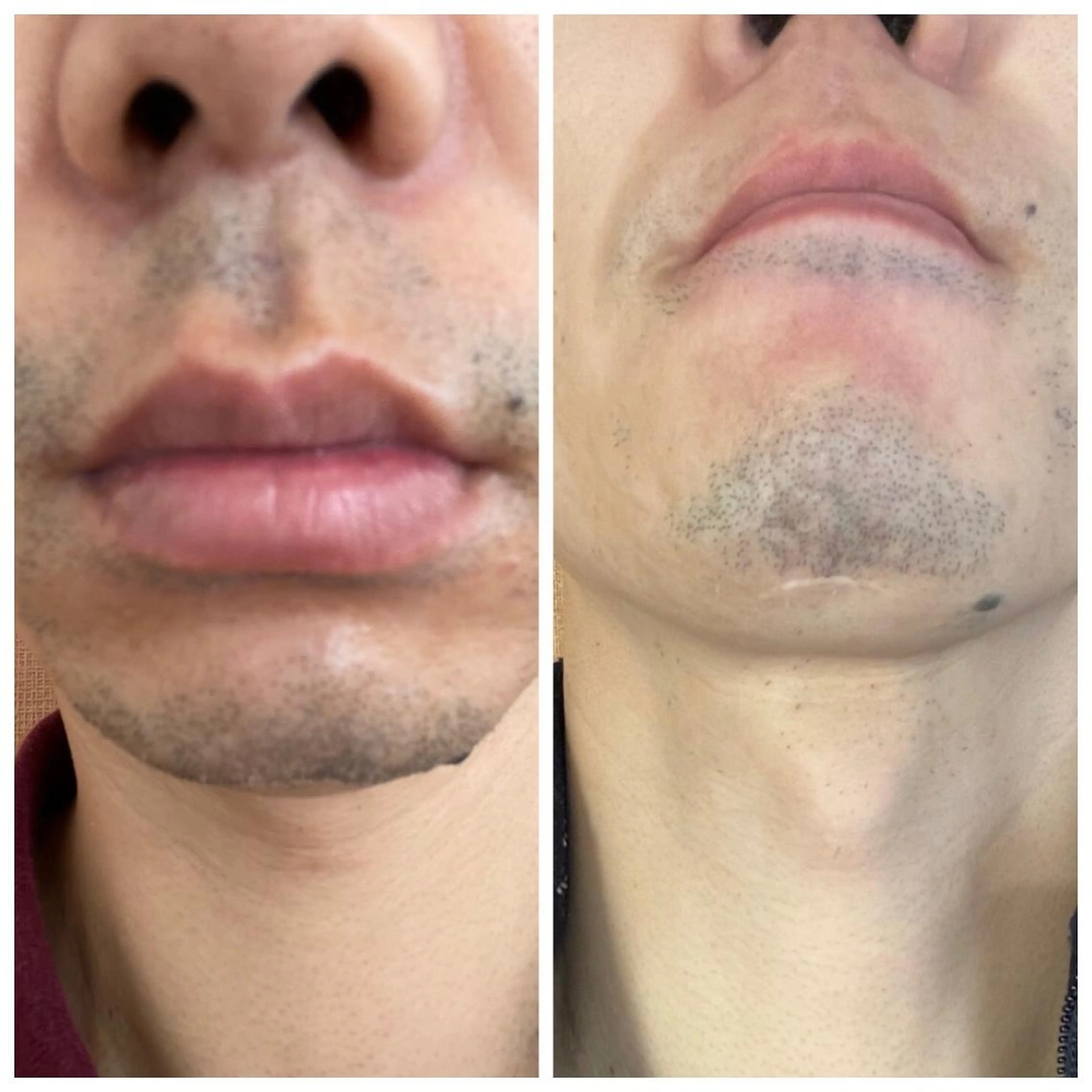 脱毛 muscle＆esthe jonny's beauty所属・jonny's beautyのエステ・リラクイメージ