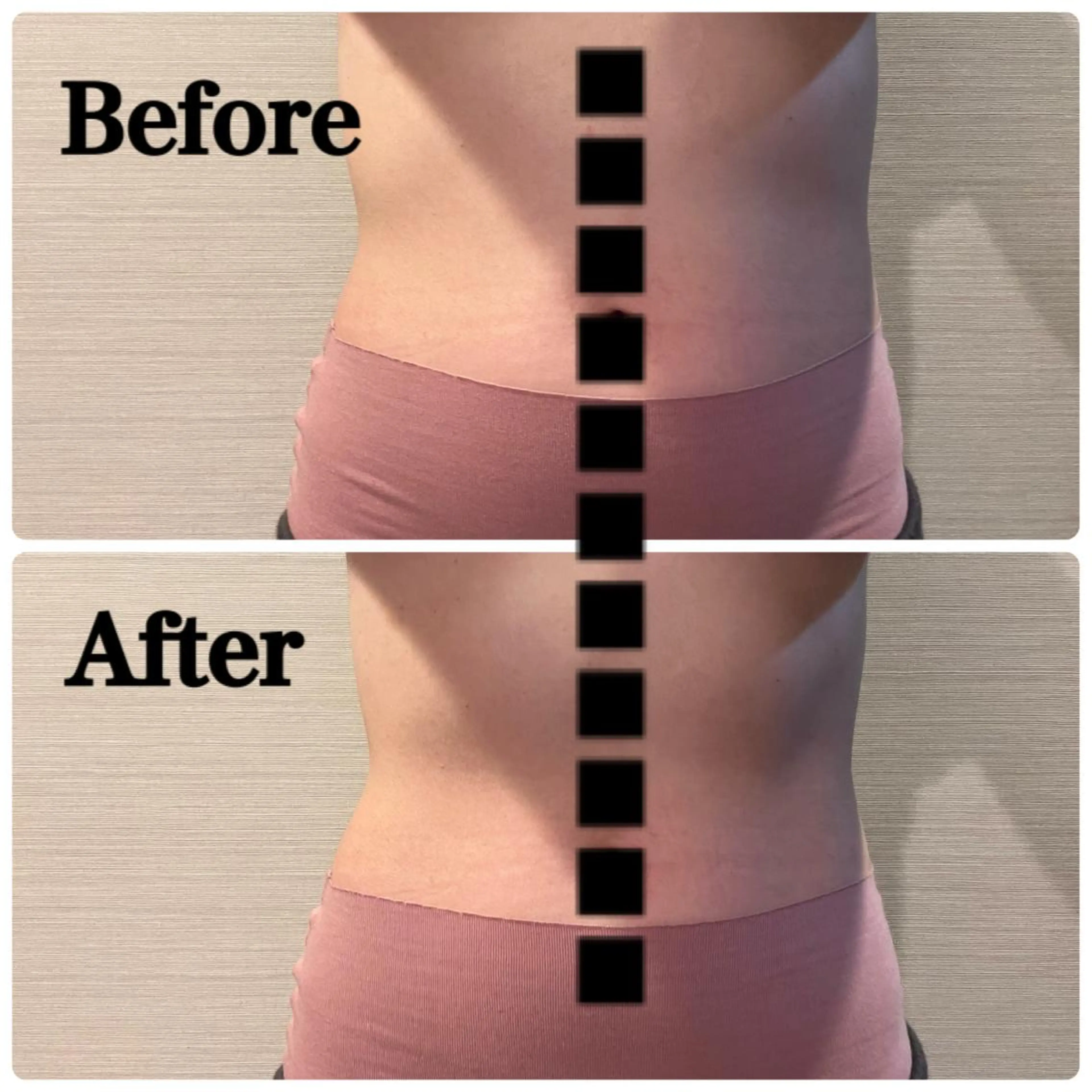 Salon Rosé 🌿漢方🌿足痩せのエステ・リラクイメージ