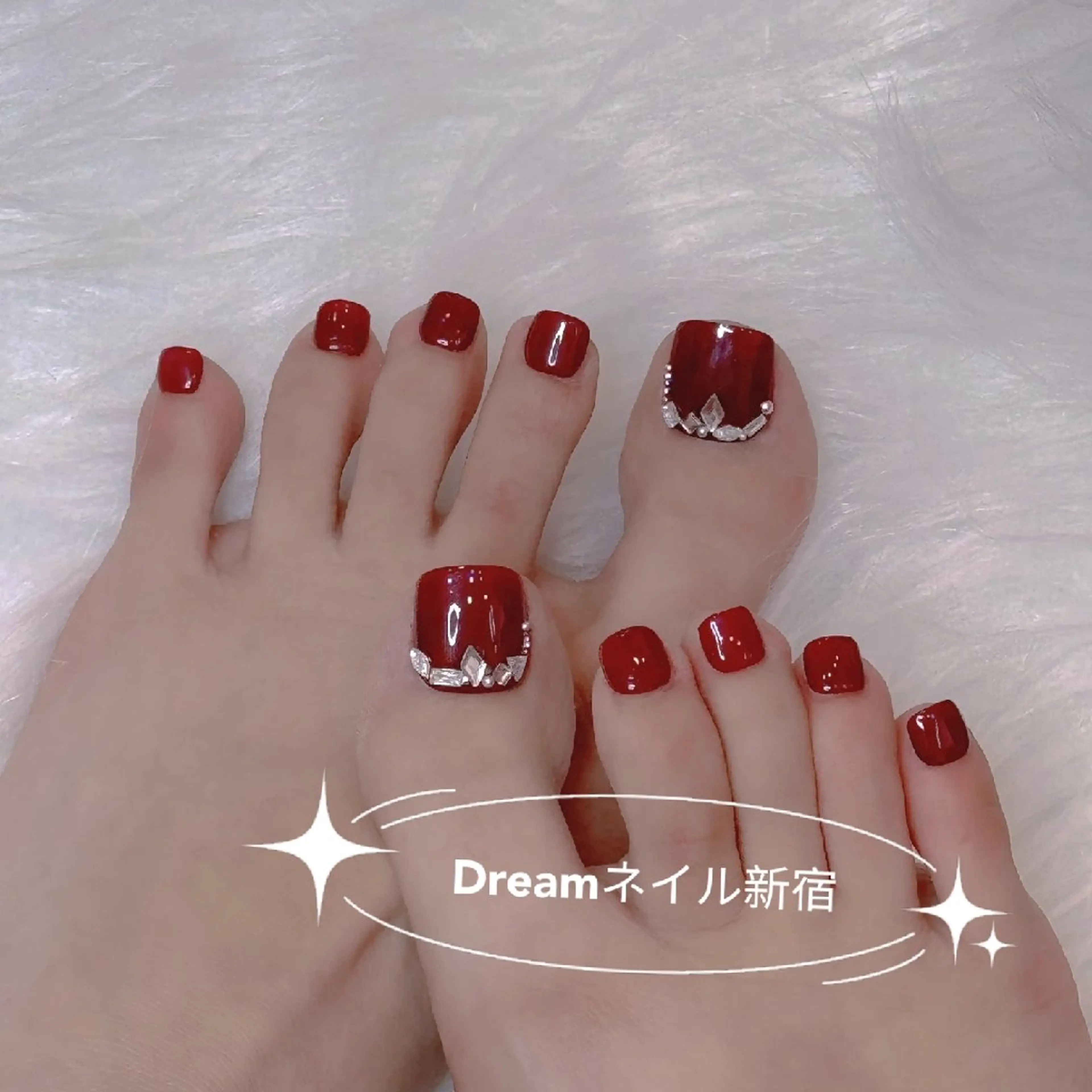 ネイル フットネイル ネイリストゆか💅 長さだし、深爪矯正のネイルデザイン