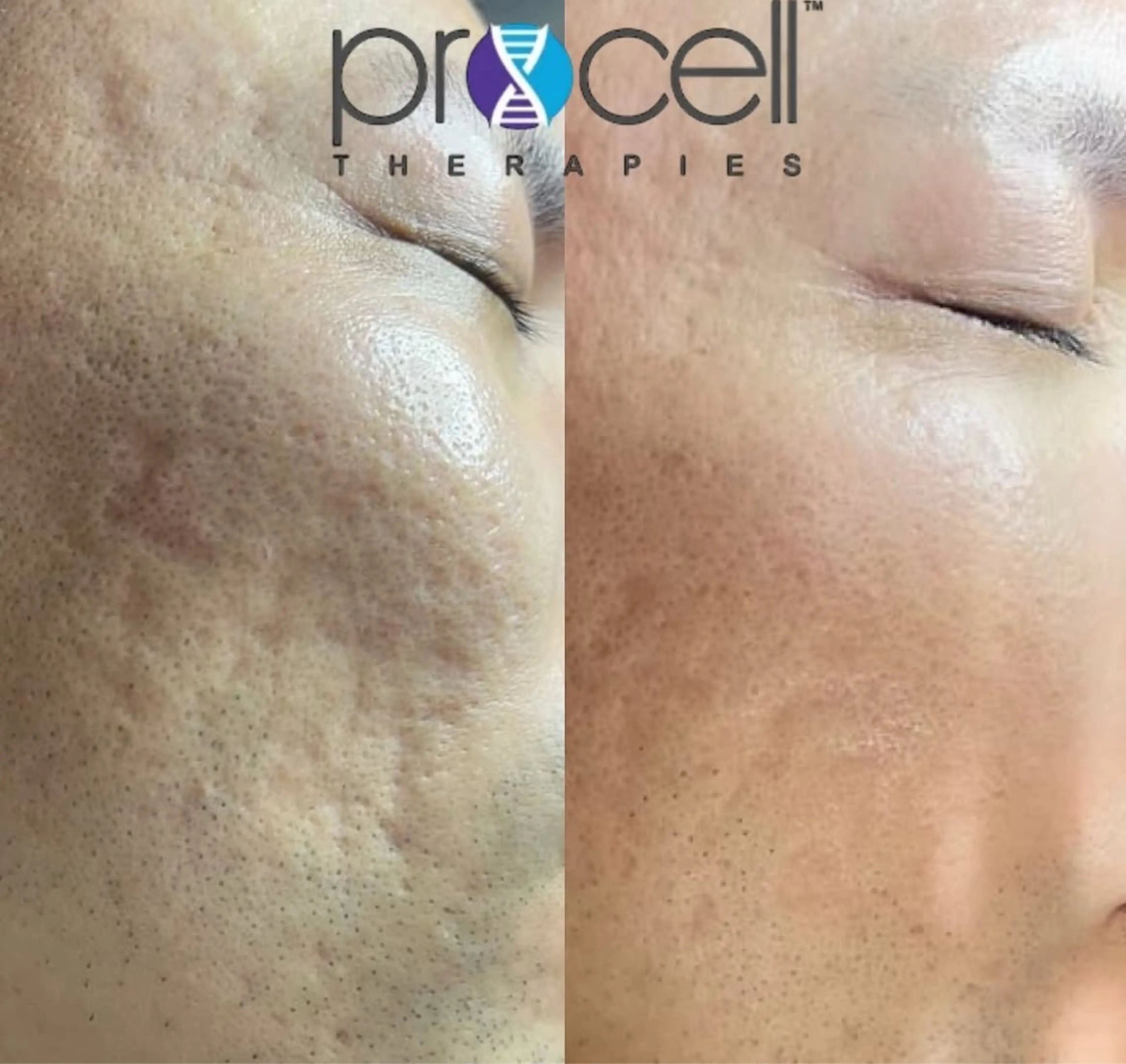 Blooming所属・LOUISE. ／肌質・頭皮のエステ・リラクイメージ