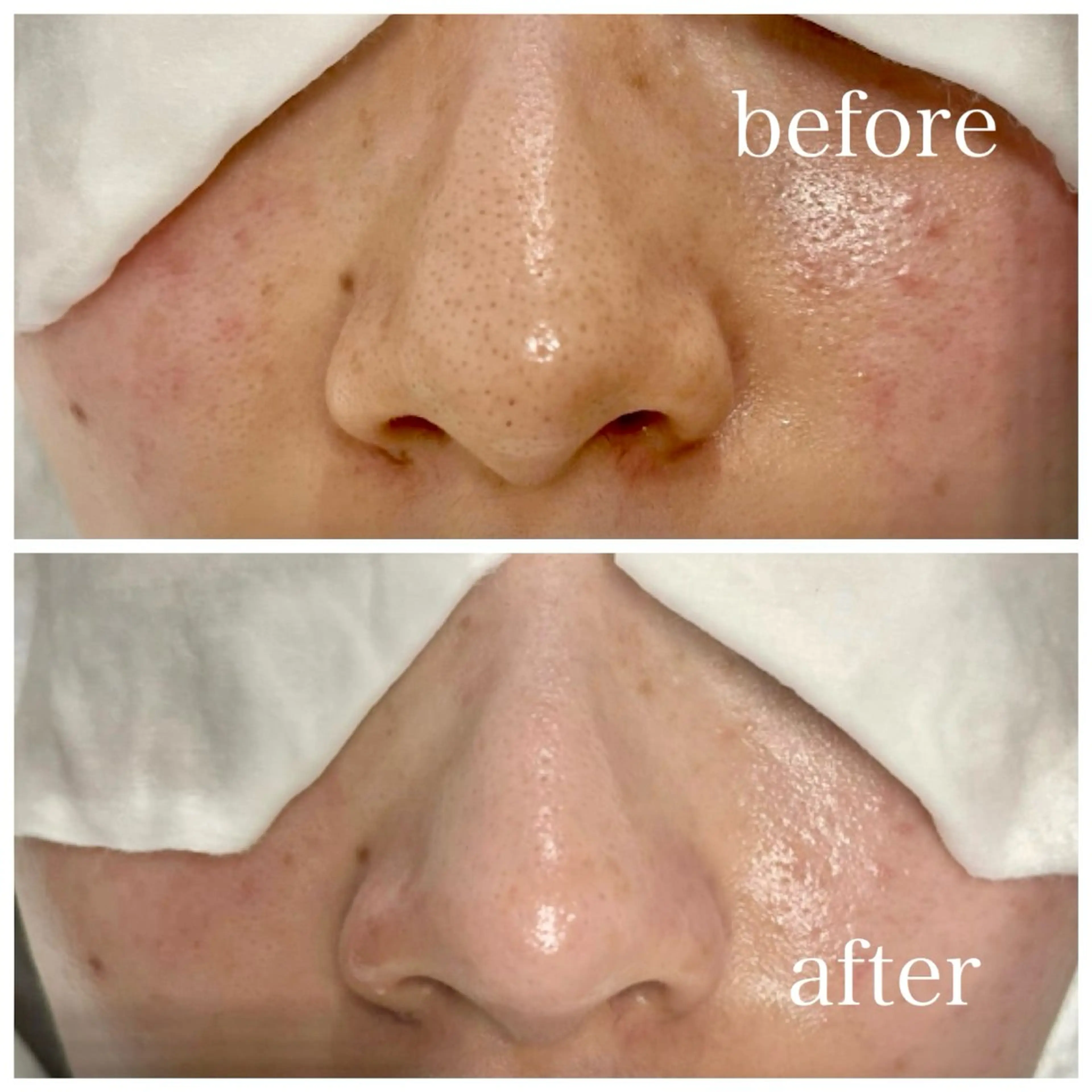 NóF .のマツエク・マツパデザイン