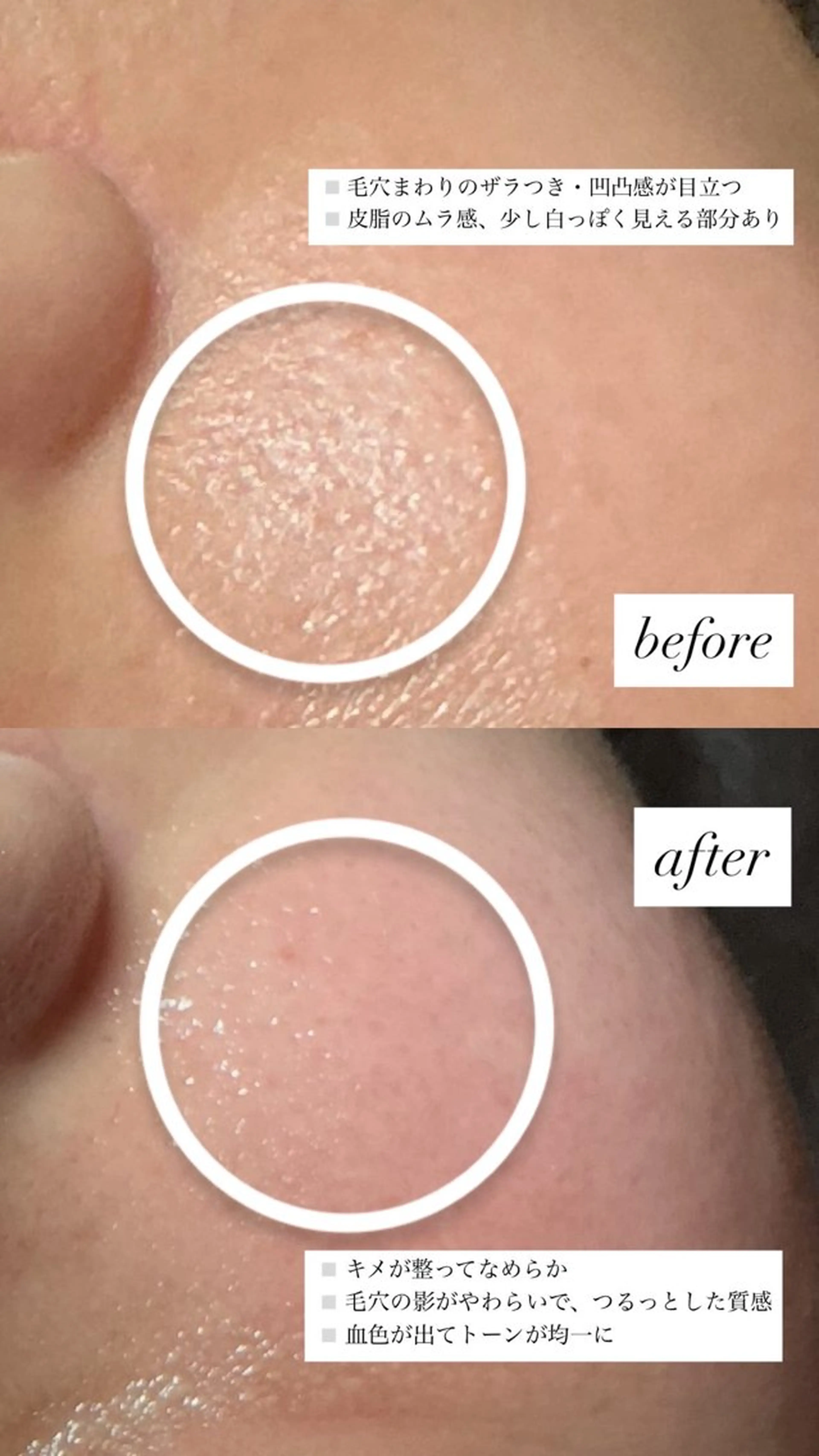 《マシュマロ肌ケア》赤み、乾燥、敏感肌 ¥8,800 → ¥4,000毛穴洗浄＋ヒト幹細胞＋特殊パックの写真