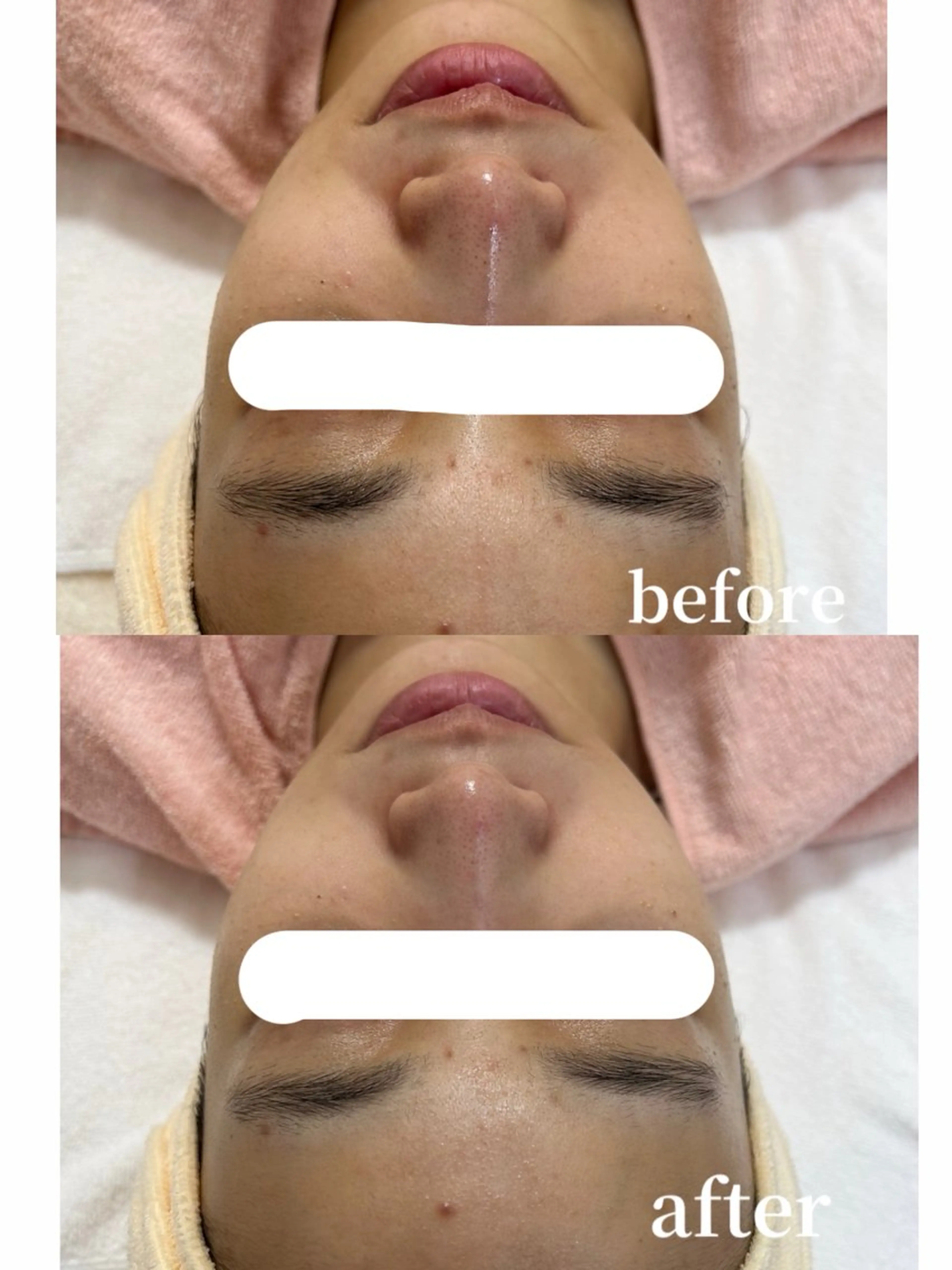 ディープクレンジング60分💆🏼‍♀️🫧【お仕上げメイク付き💄】の写真