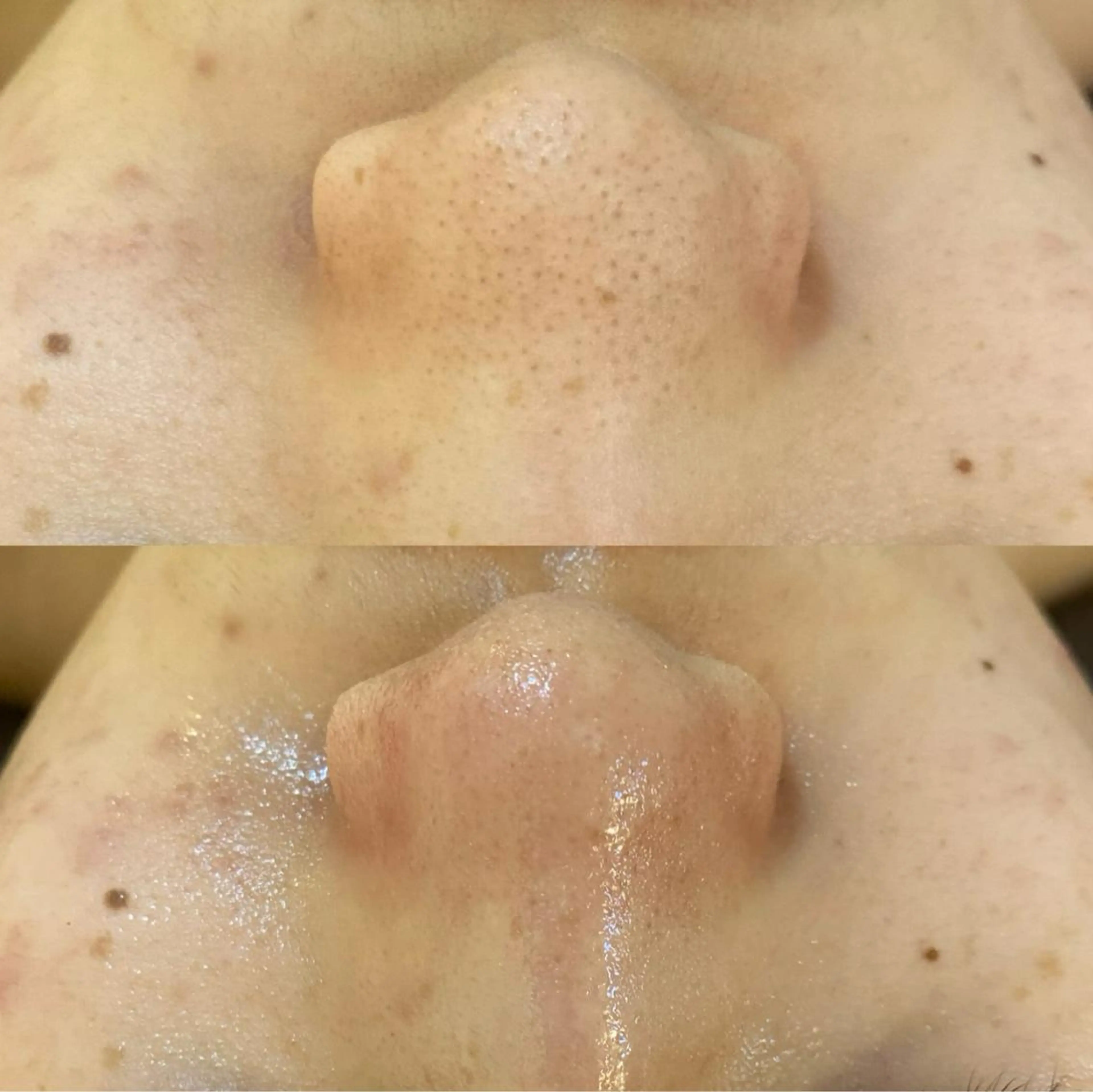 エステ リラク BELCIA福岡店　récolte de BELCIA（レコルトデベルシア）所属・BELCIA福岡店 レコルトデベルシアのエステ・リラクイメージ