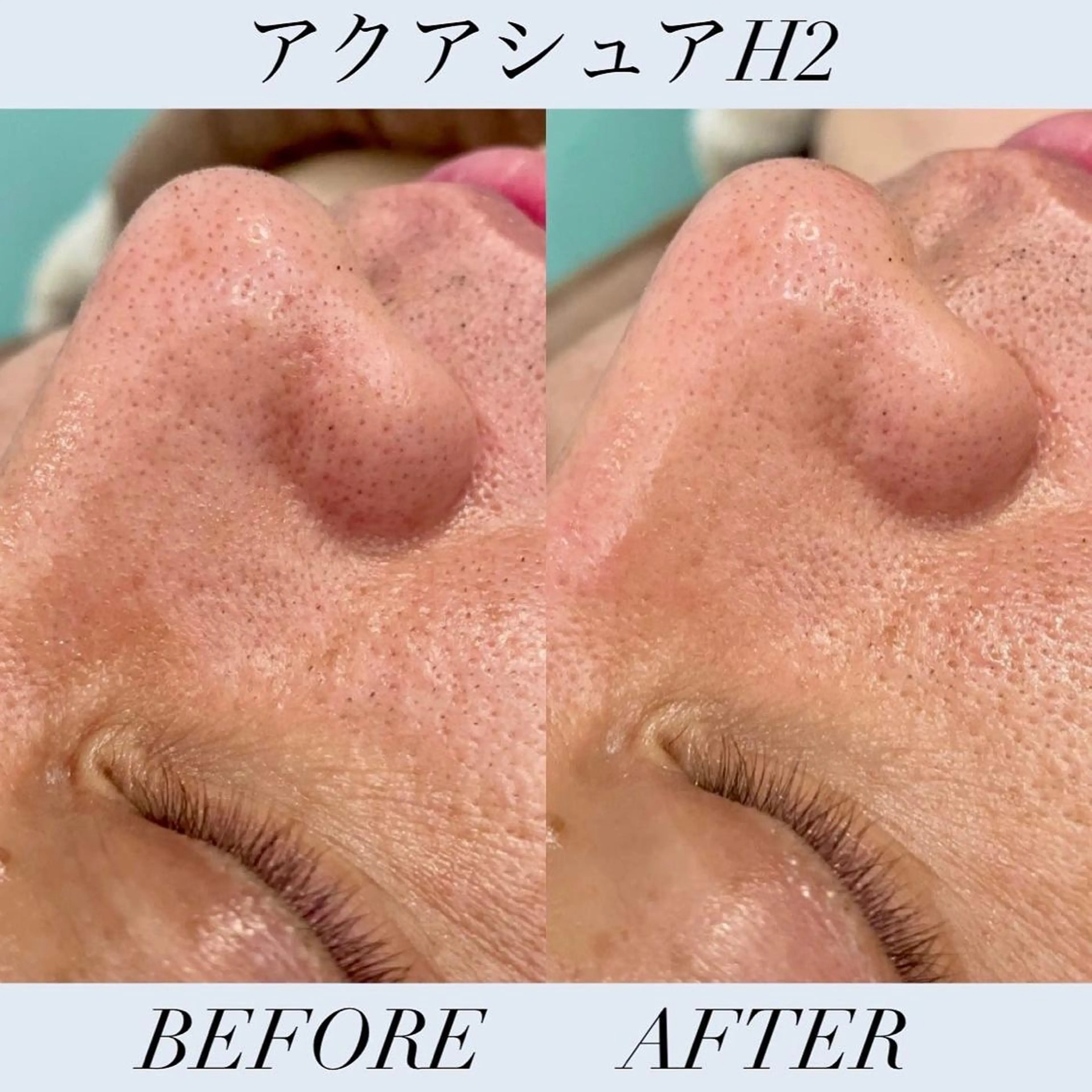 メンズ エステ 小顔、リフトアップ Lumière所属・小顔・美肌 ルミエールのエステ・リラクイメージ