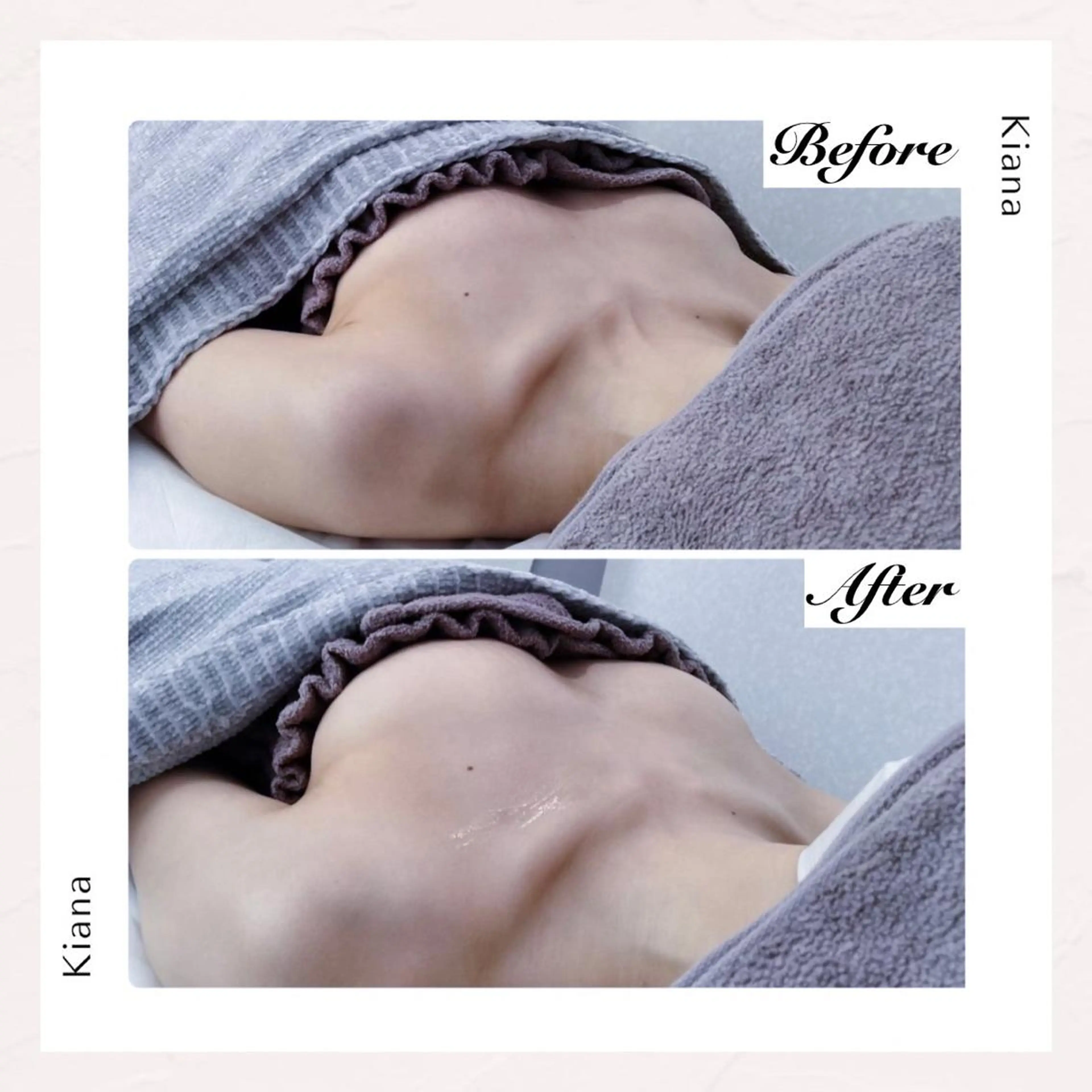 バスト専門Kiana 風のエステ・リラクイメージ