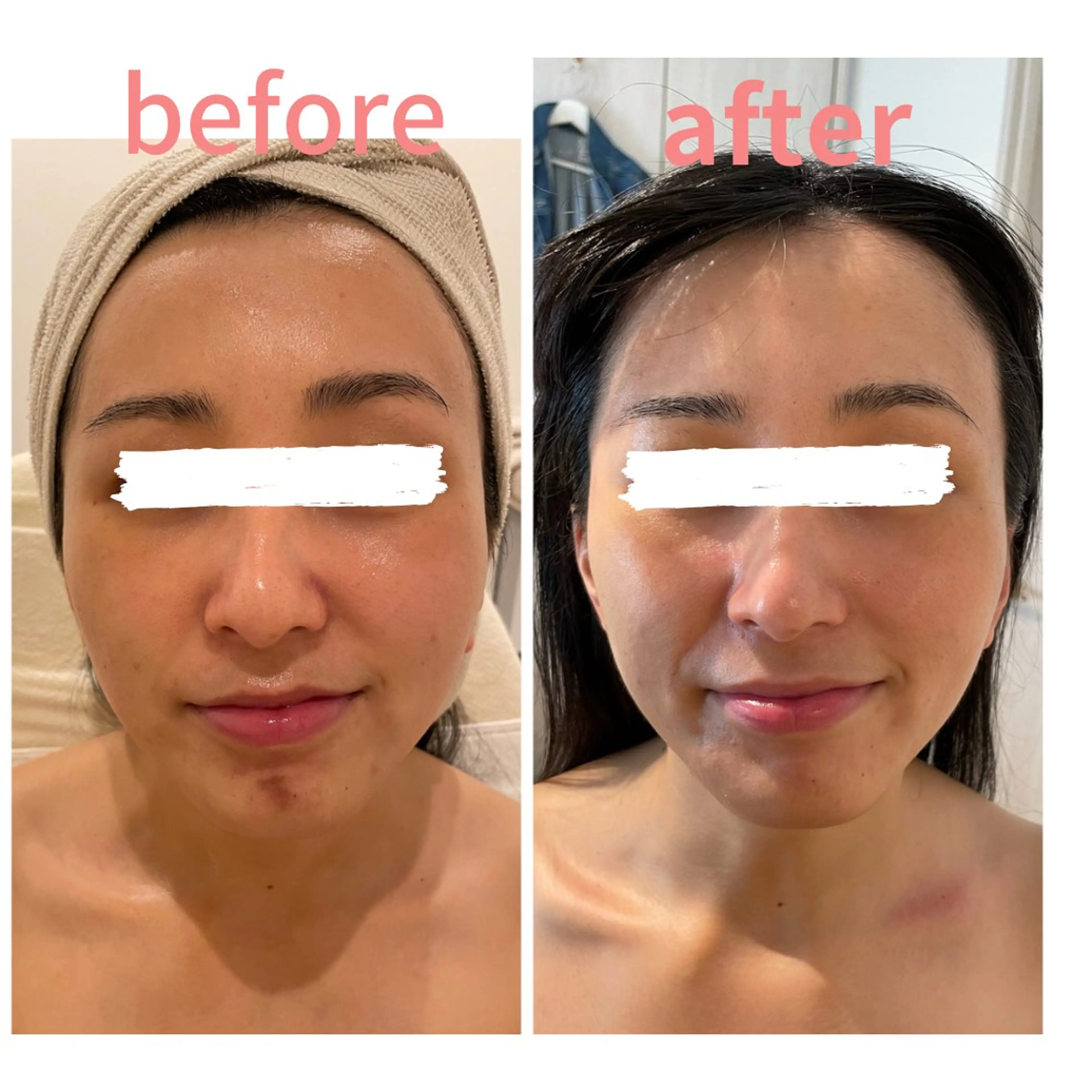 POLA NATURUのエステ・リラクイメージ