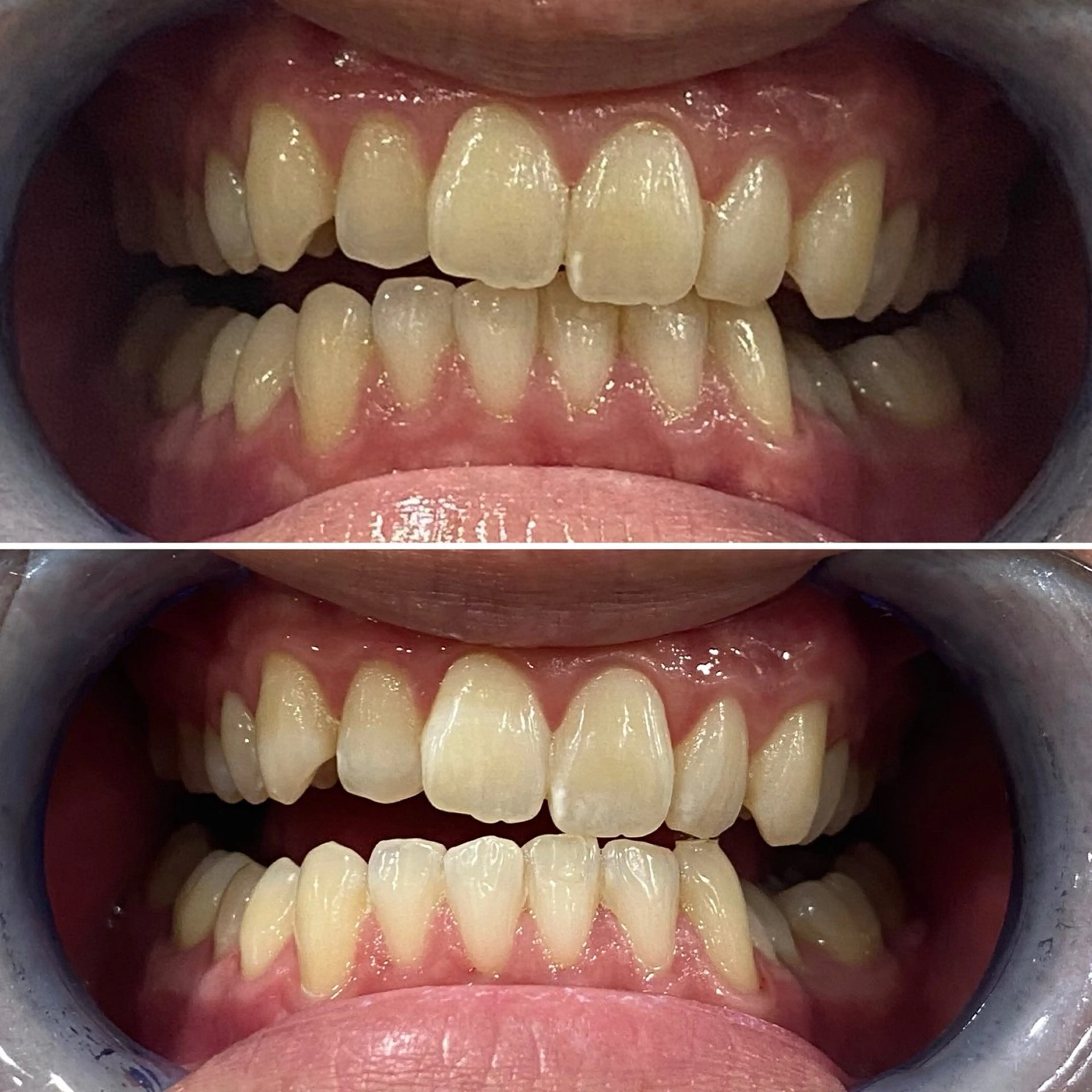 メンズ その他 whiteclub.THREE福島店所属・whiteclub THREEのその他イメージ