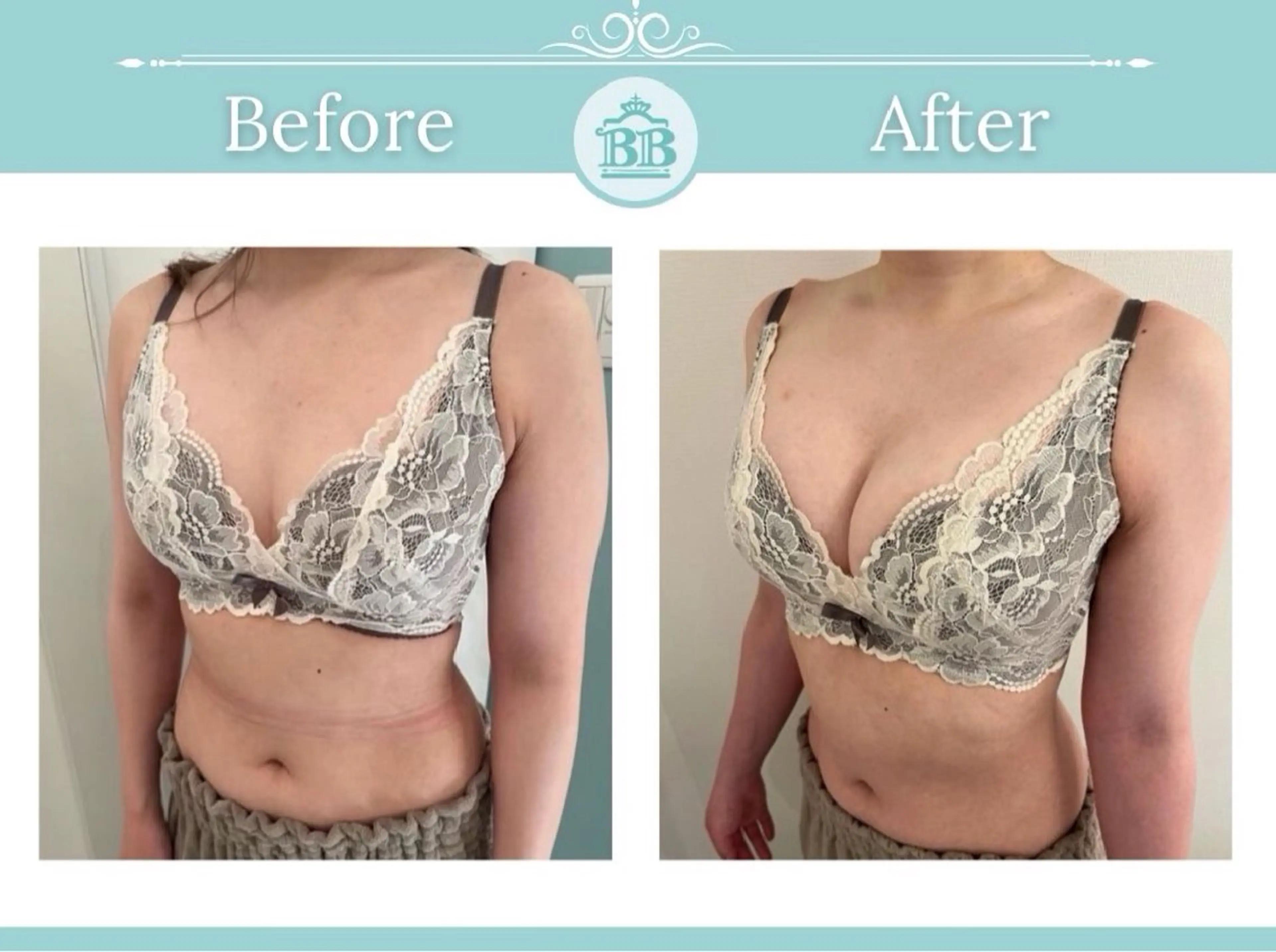 エステ 美人バスト本厚木店所属・美人バスト 本厚木店のエステ・リラクイメージ