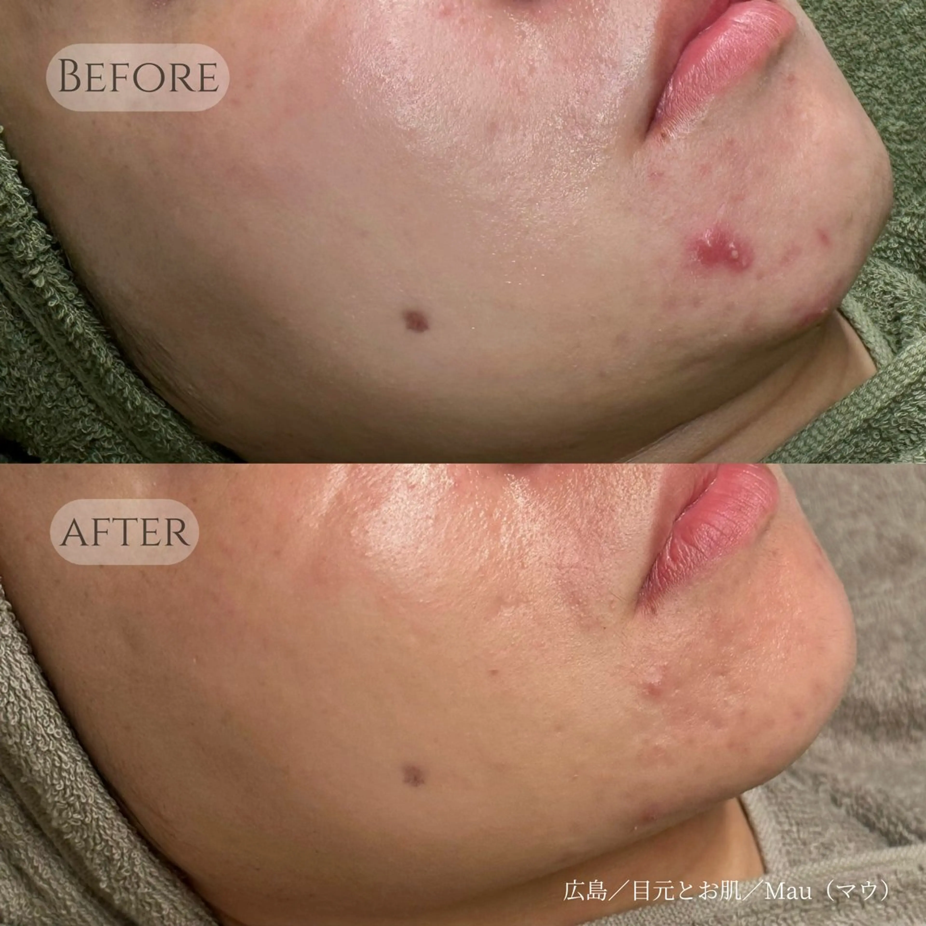 Mau beauty salon所属・Mau (マウ)のエステ・リラクイメージ