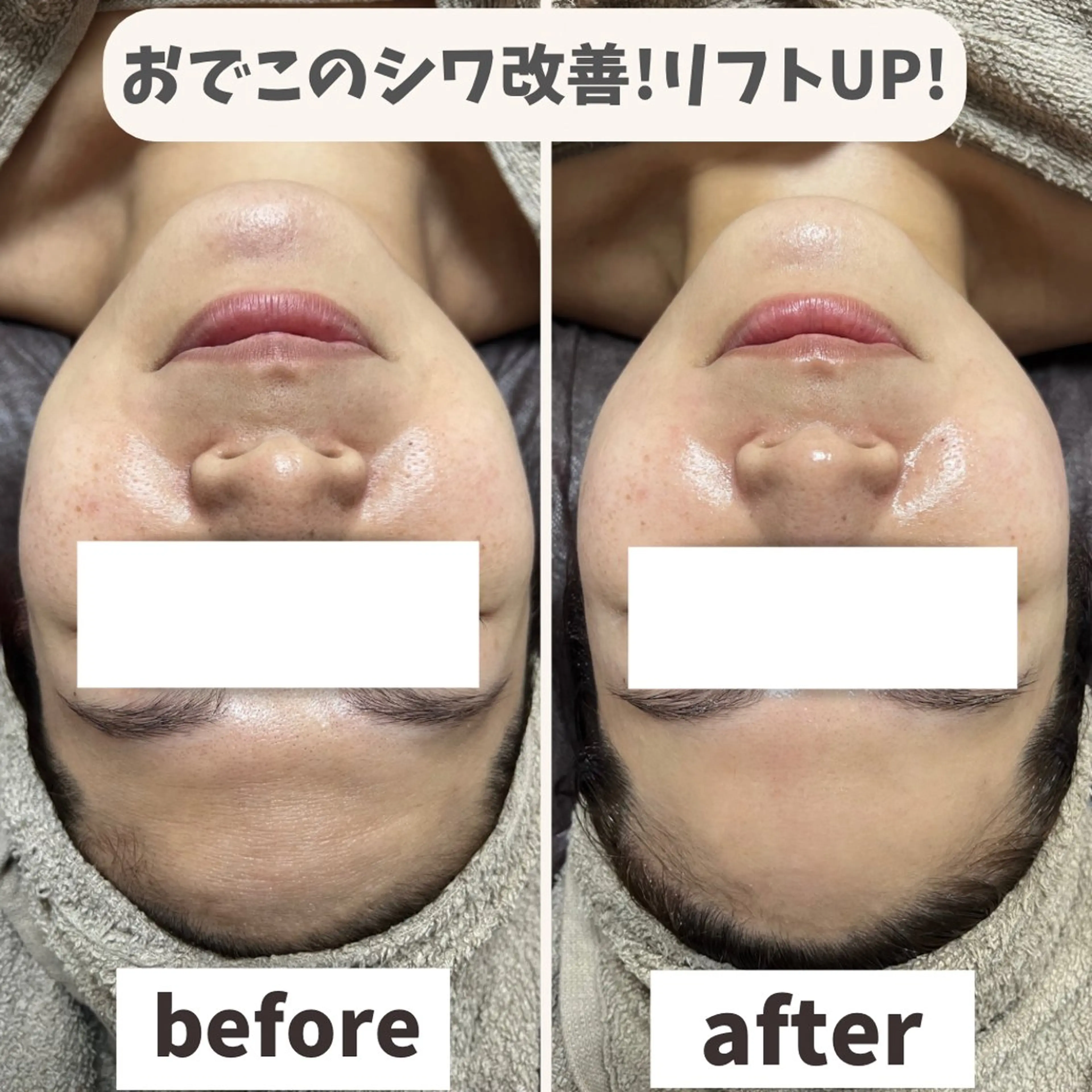 エステ リラク ReN所属・ReN エステサロンのエステ・リラクイメージ