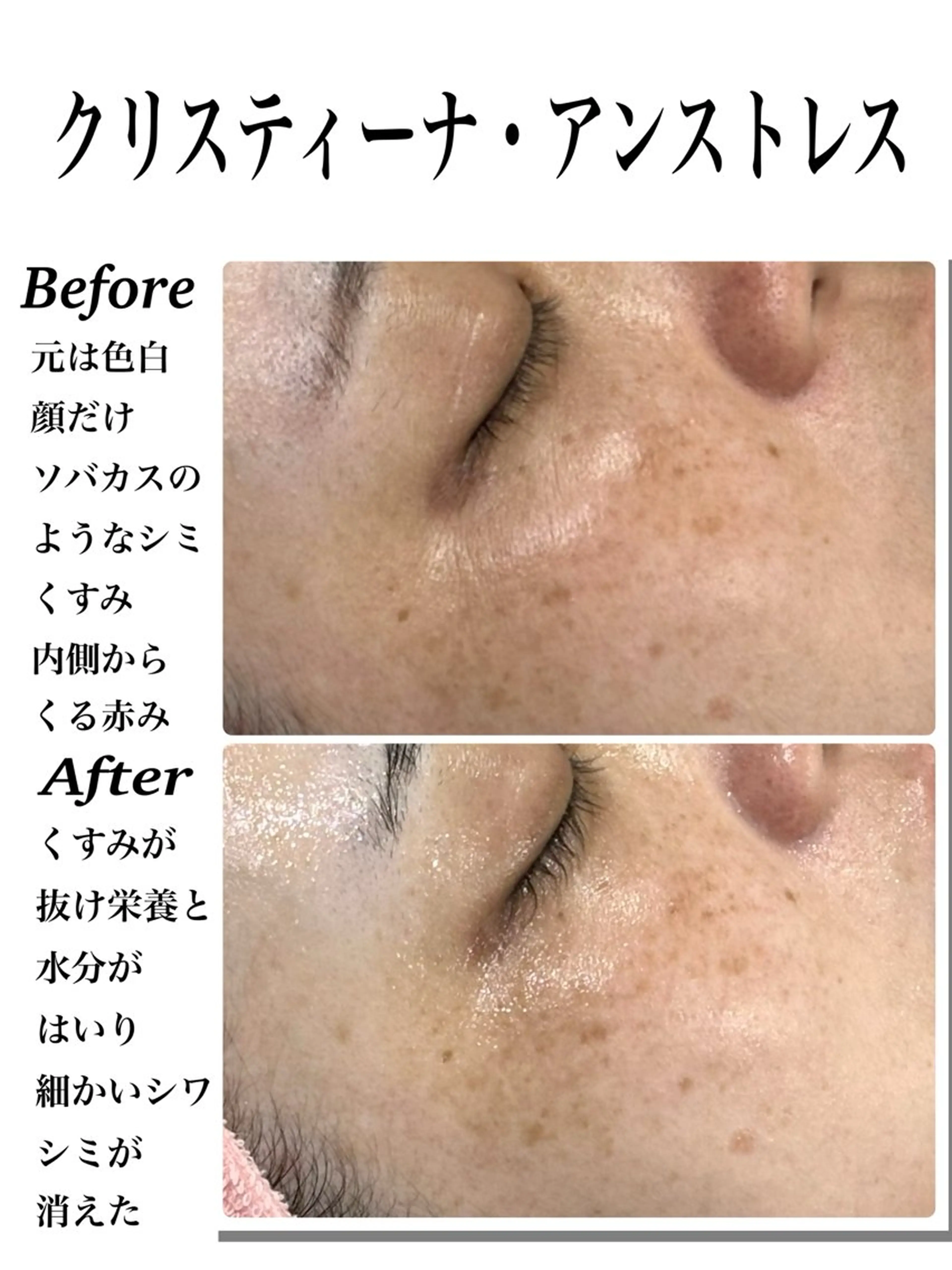 エステ 効果重視脱毛サロンRICE所属・肌質改善/都度脱毛 Mahinaのエステ・リラクイメージ