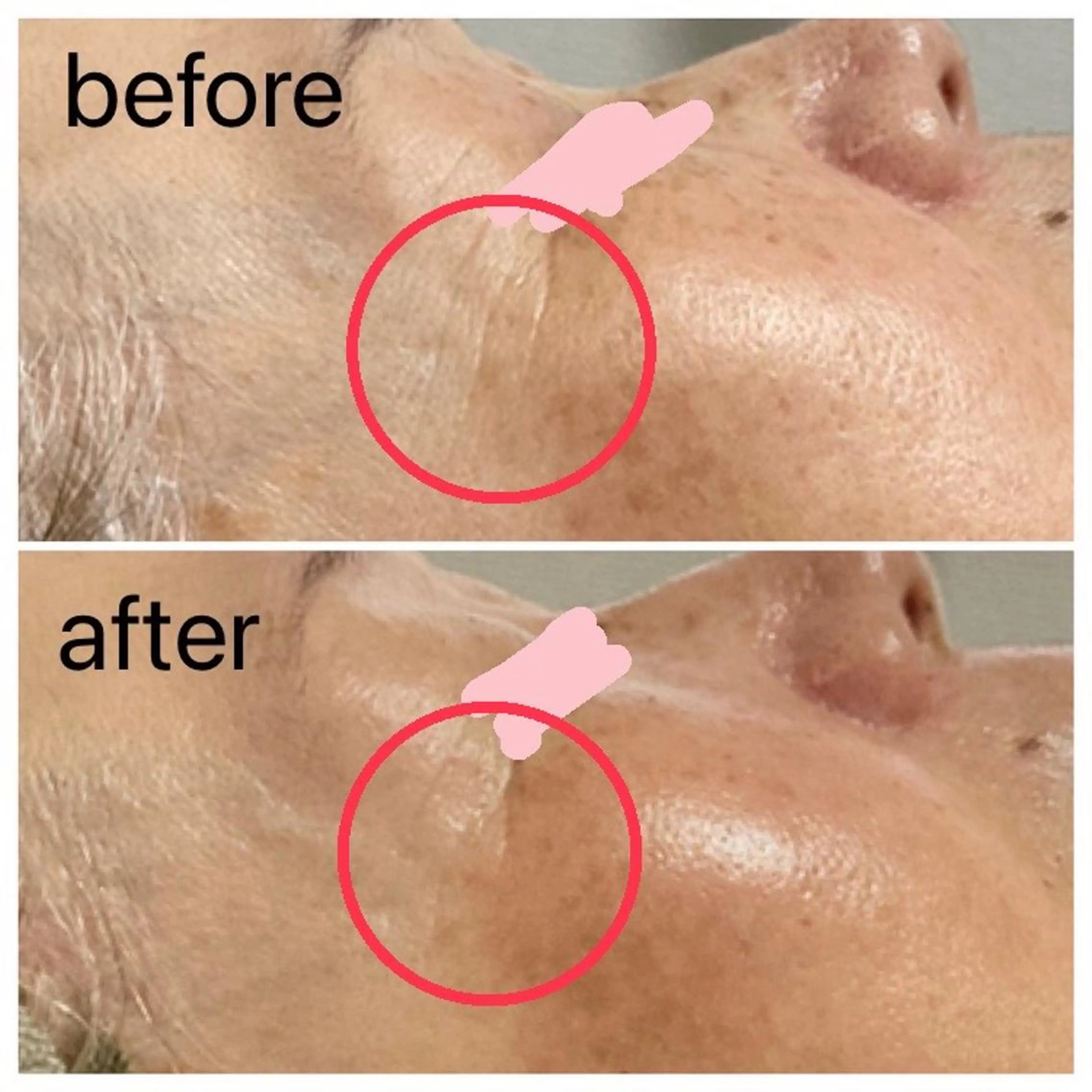 シワ・エイジングケアの写真