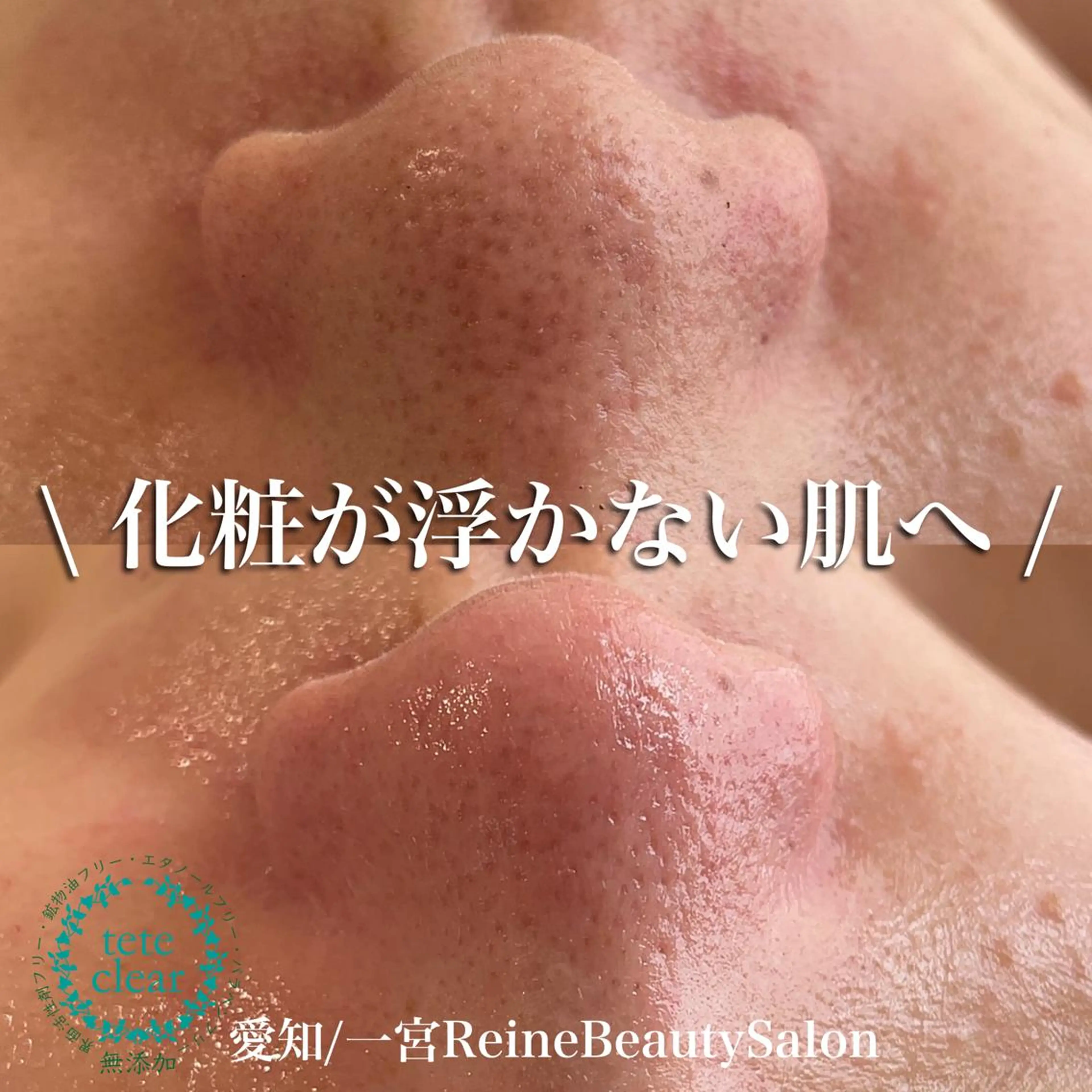 エステ Reine BeautySalon所属・毛穴/シミ肝斑/脱毛 横山梨里のエステ・リラクイメージ