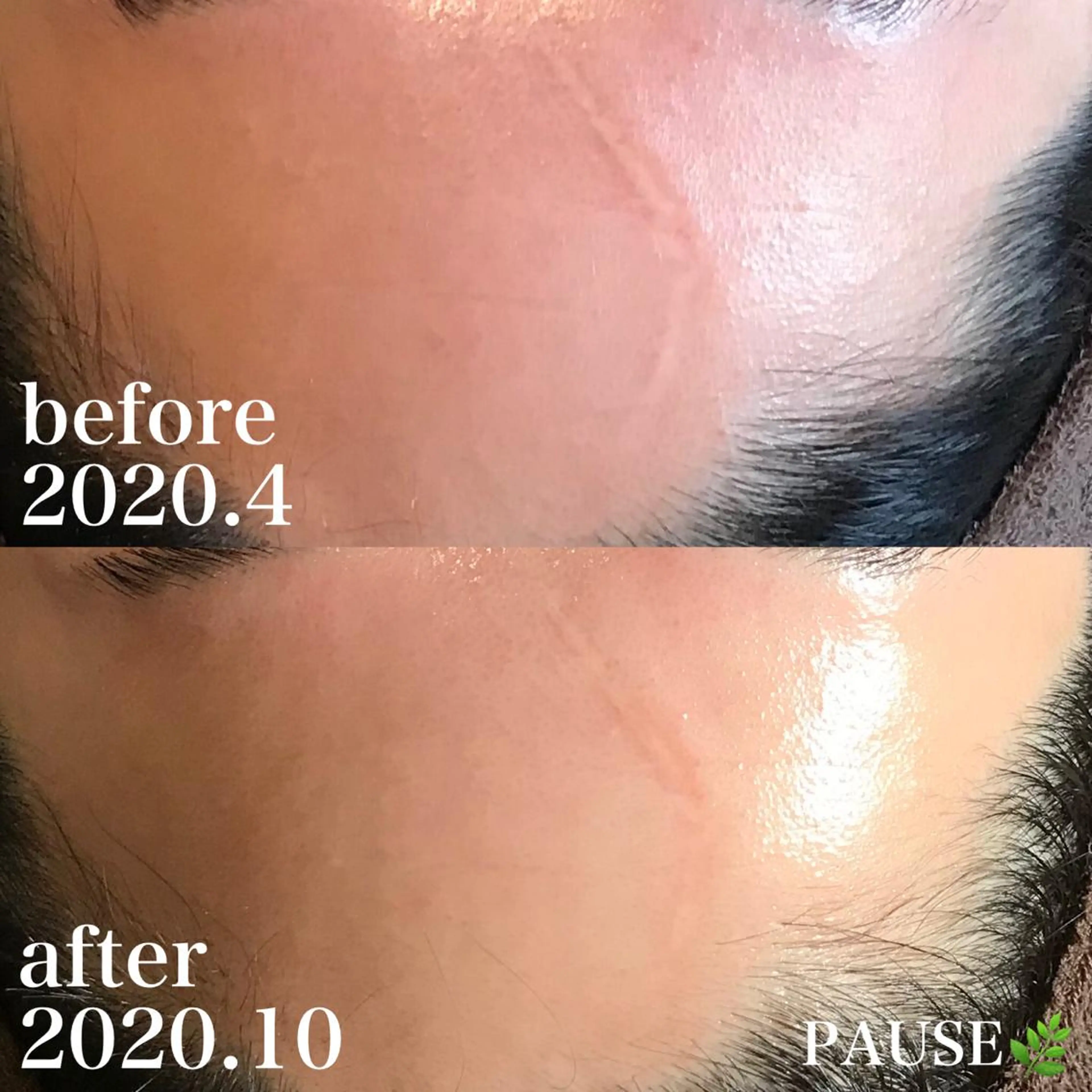 エステ 浜野 恵美のエステ・リラクイメージ