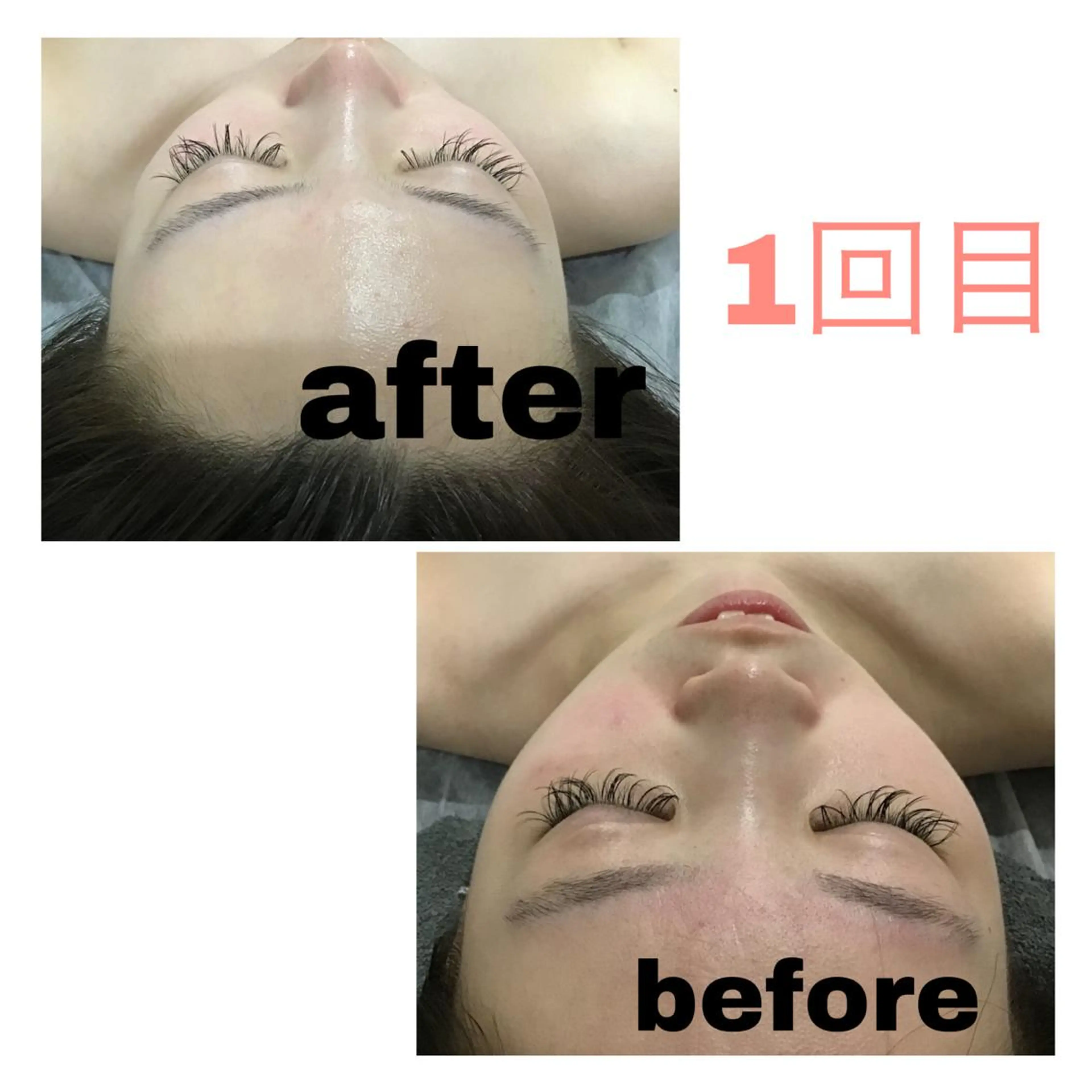 無料カウンセリングの写真