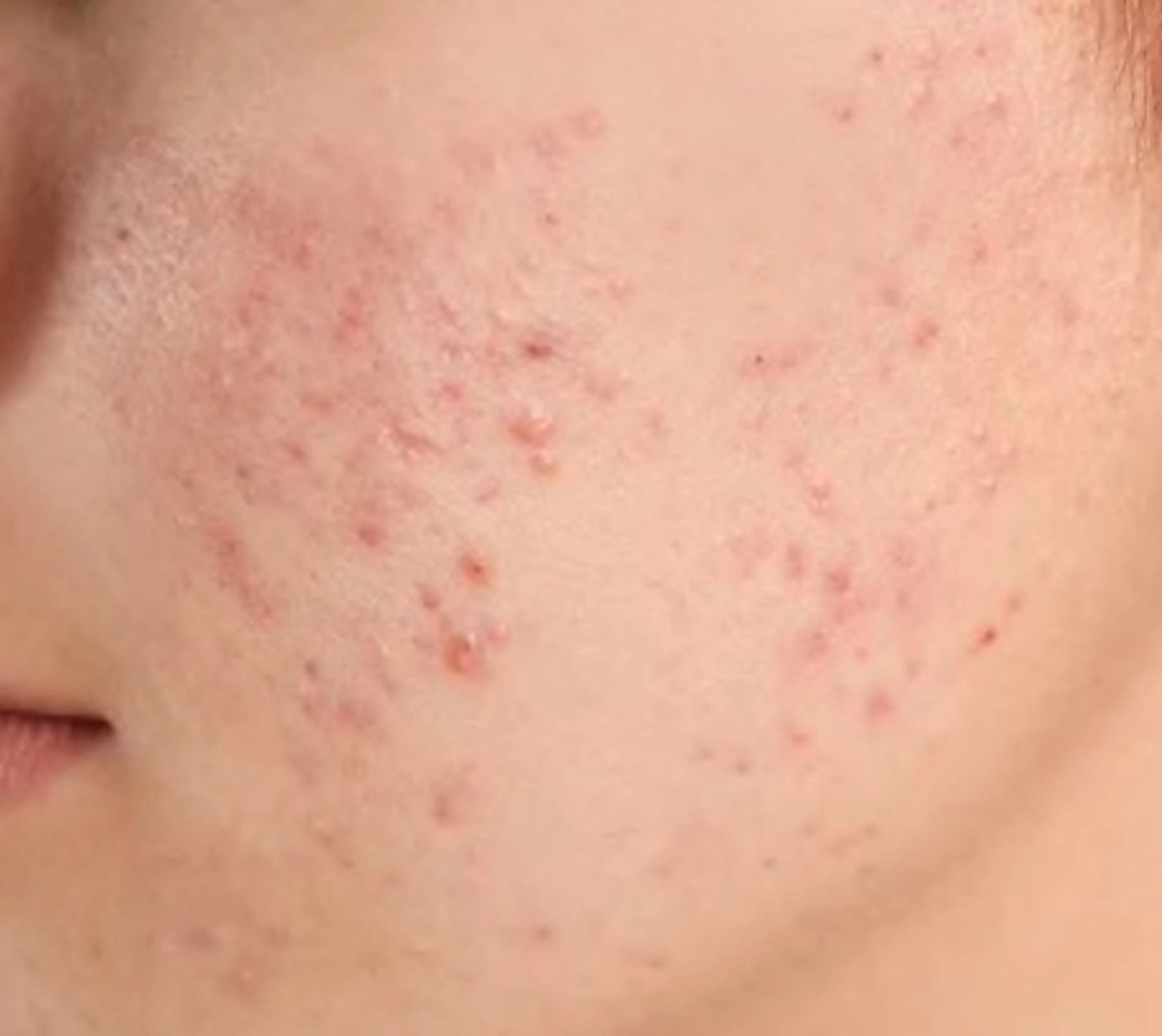 🅖🅤🅩🅔🅛 salonのエステ・リラクイメージ