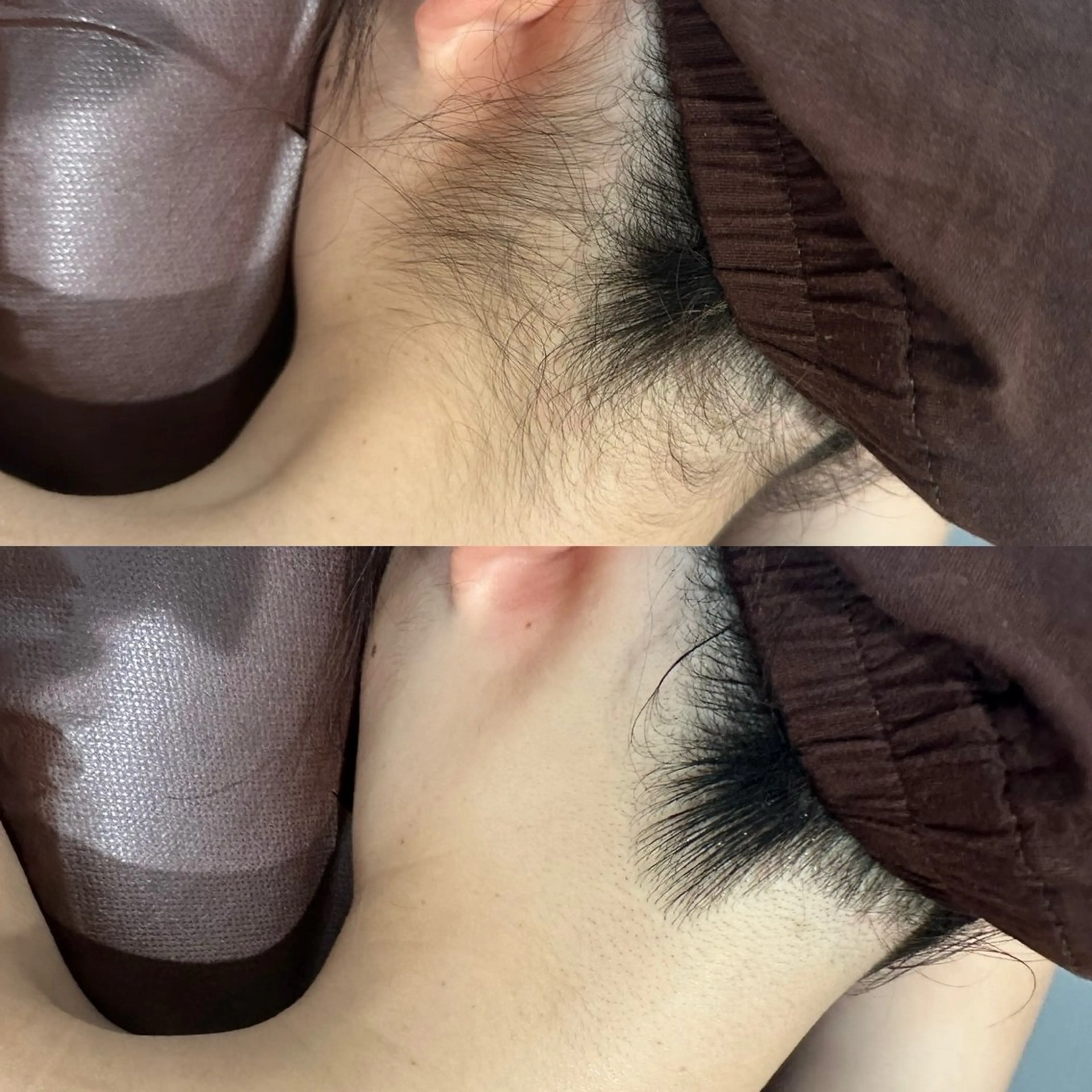 脱毛 mili mili beauty salon所属・mili mili 岡本のエステ・リラクイメージ