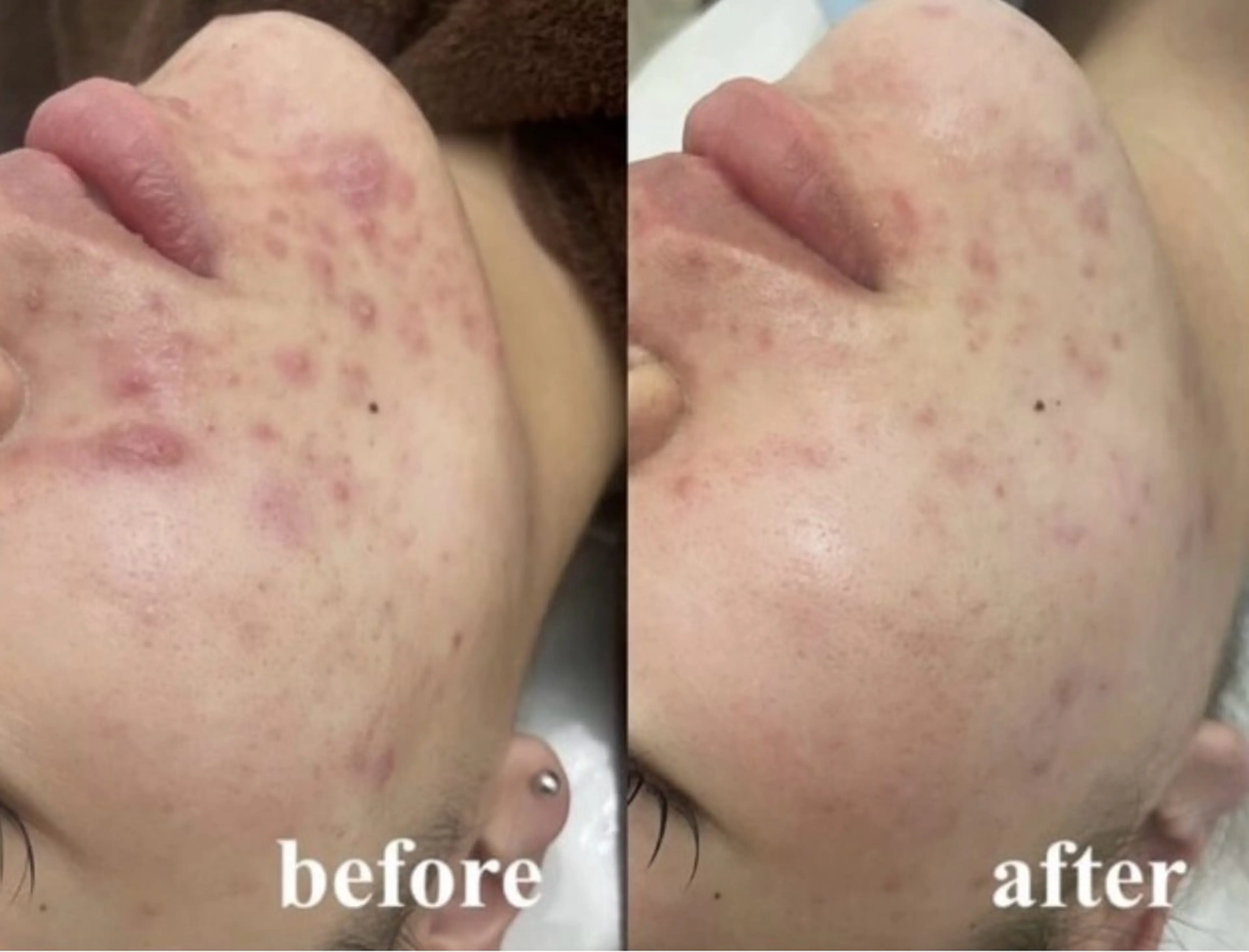 エステ Salon de sharmant所属・岡 本のエステ・リラクイメージ