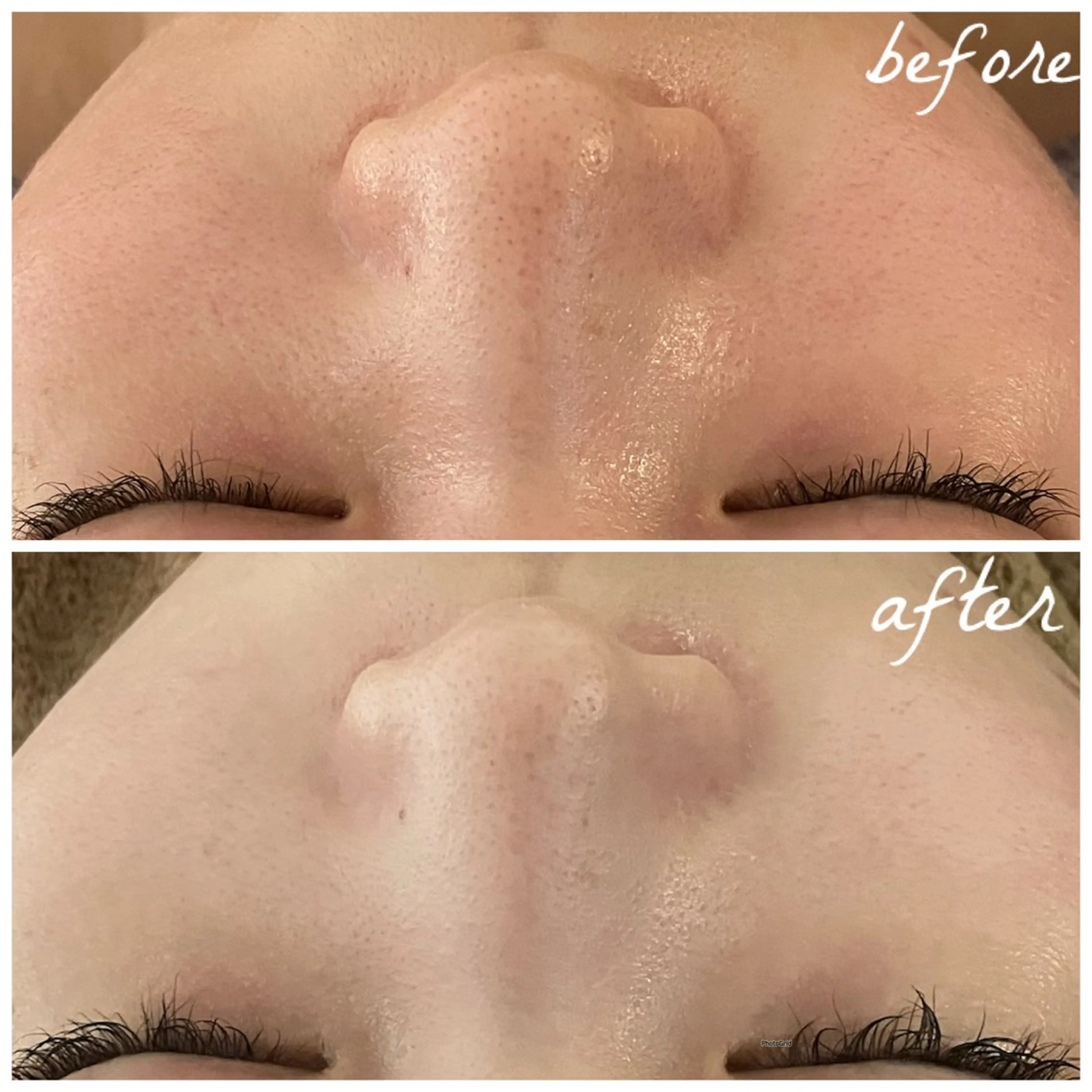 メンズ エステ メナード岐阜茜部 杉浦のエステ・リラクイメージ