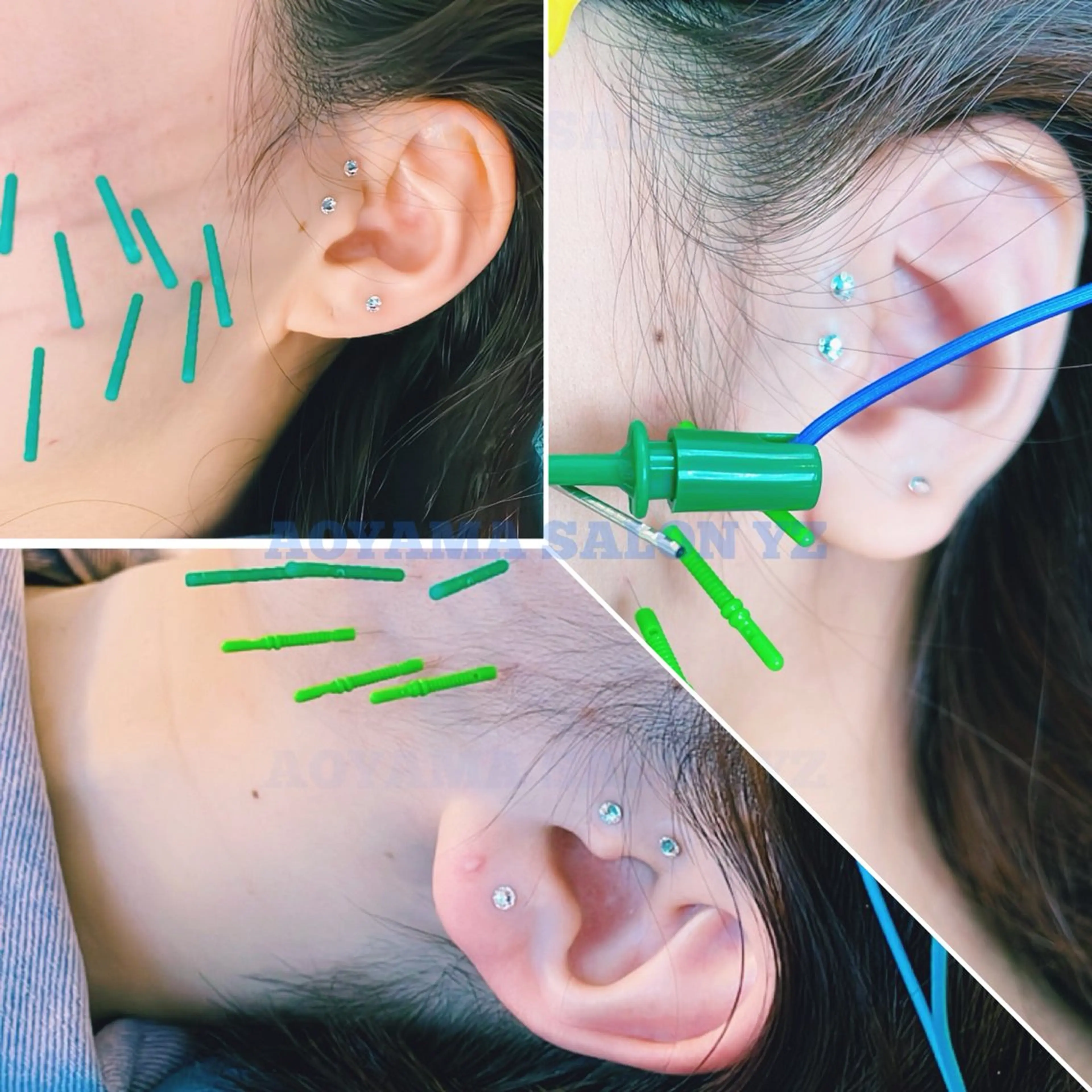 その他 小顔美容鍼専門サロン 渋谷YZのエステ・リラクイメージ