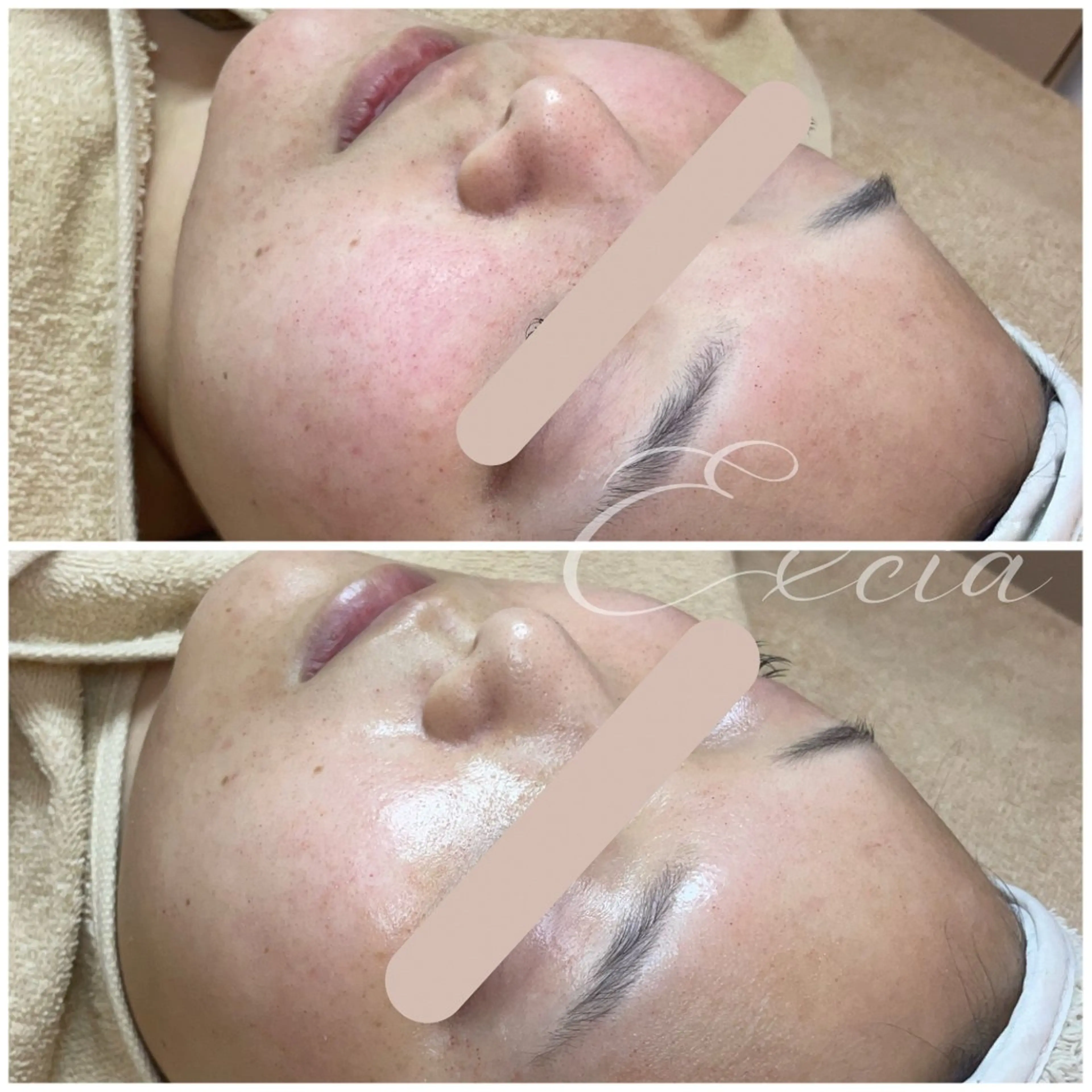 EXCIA所属・EXCIA （エクシア）のエステ・リラクイメージ