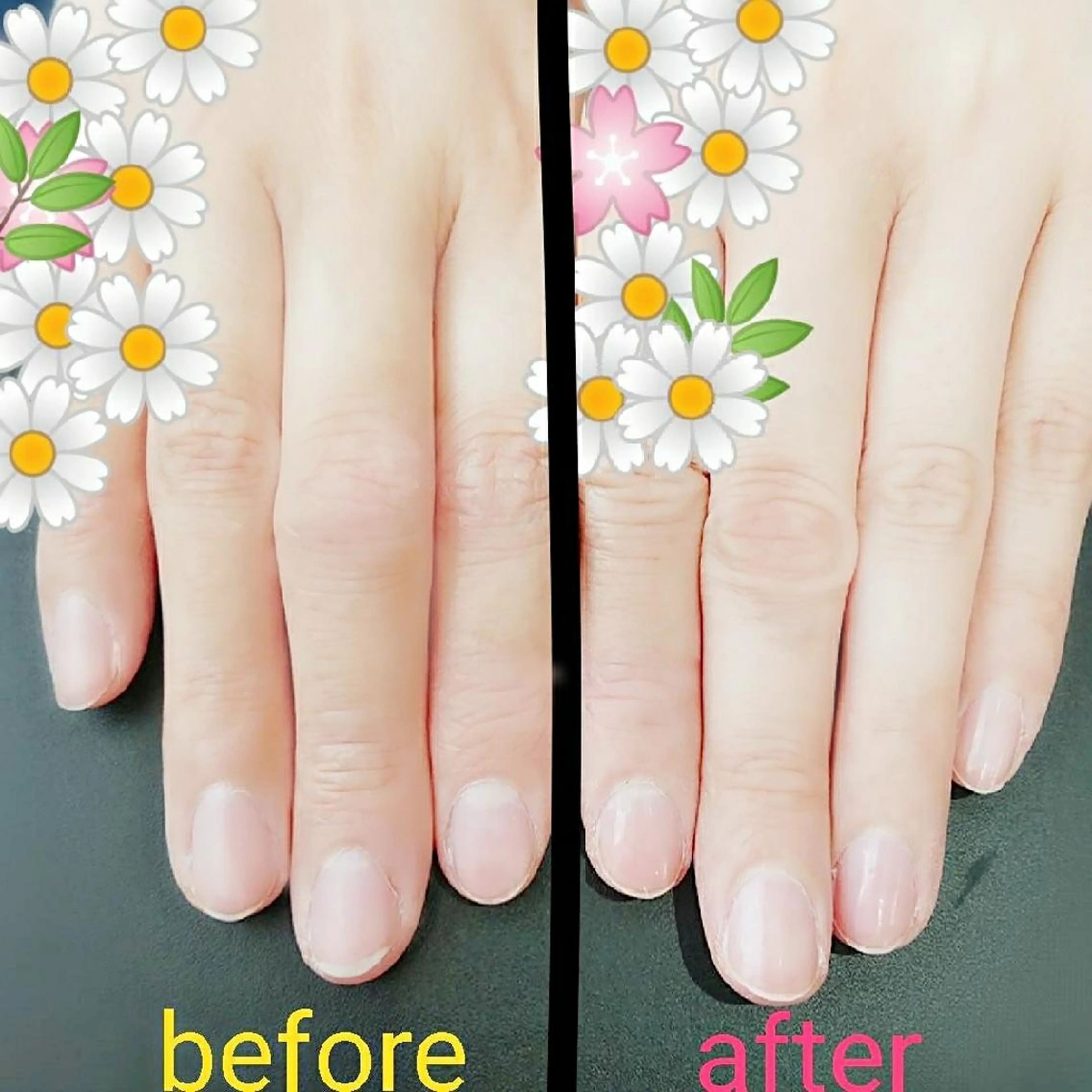 乾燥対策✨大好評❗💅ハンドネイルケアコース💅✨の写真