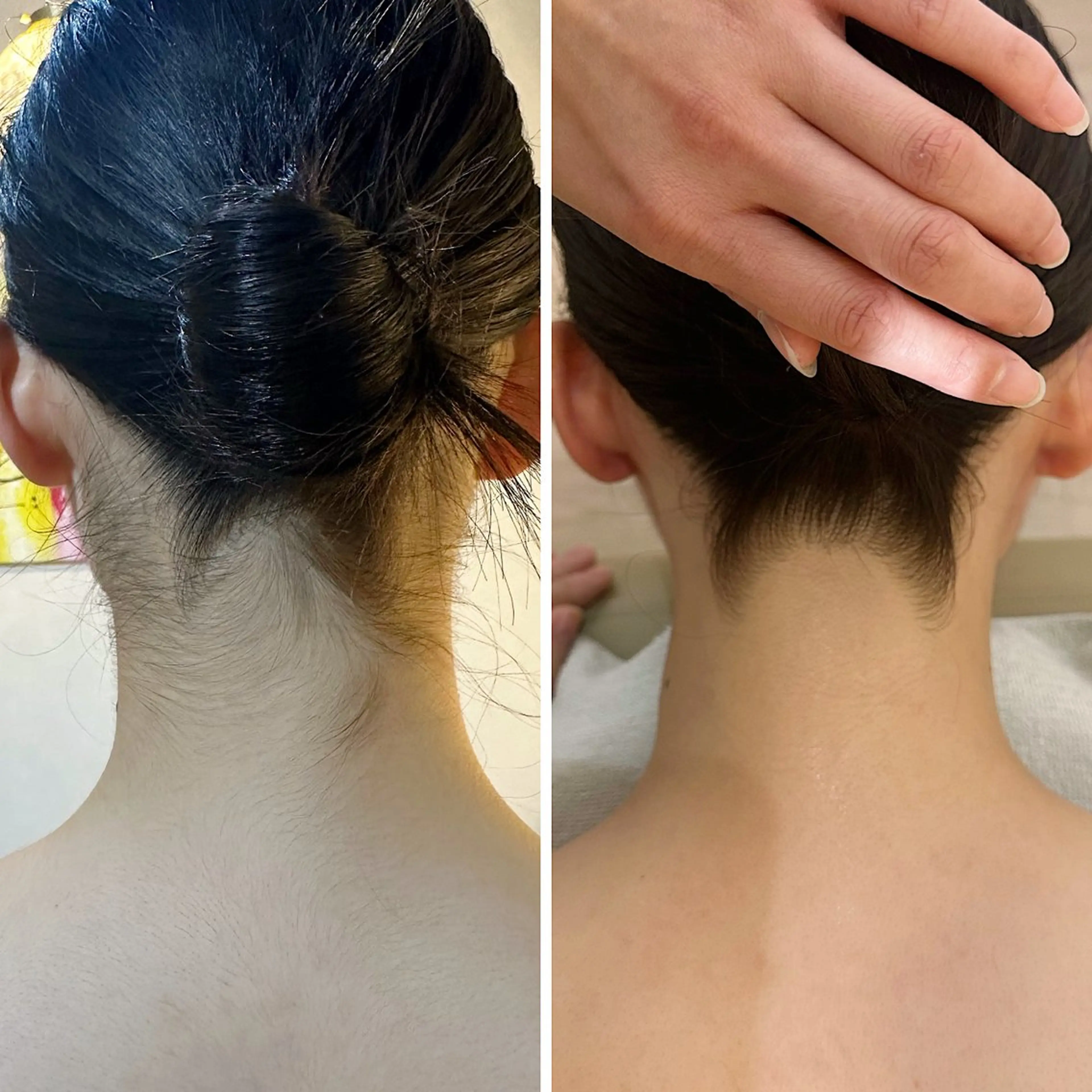 脱毛 うなじ脱毛/美肌脱毛 LABELのエステ・リラクイメージ