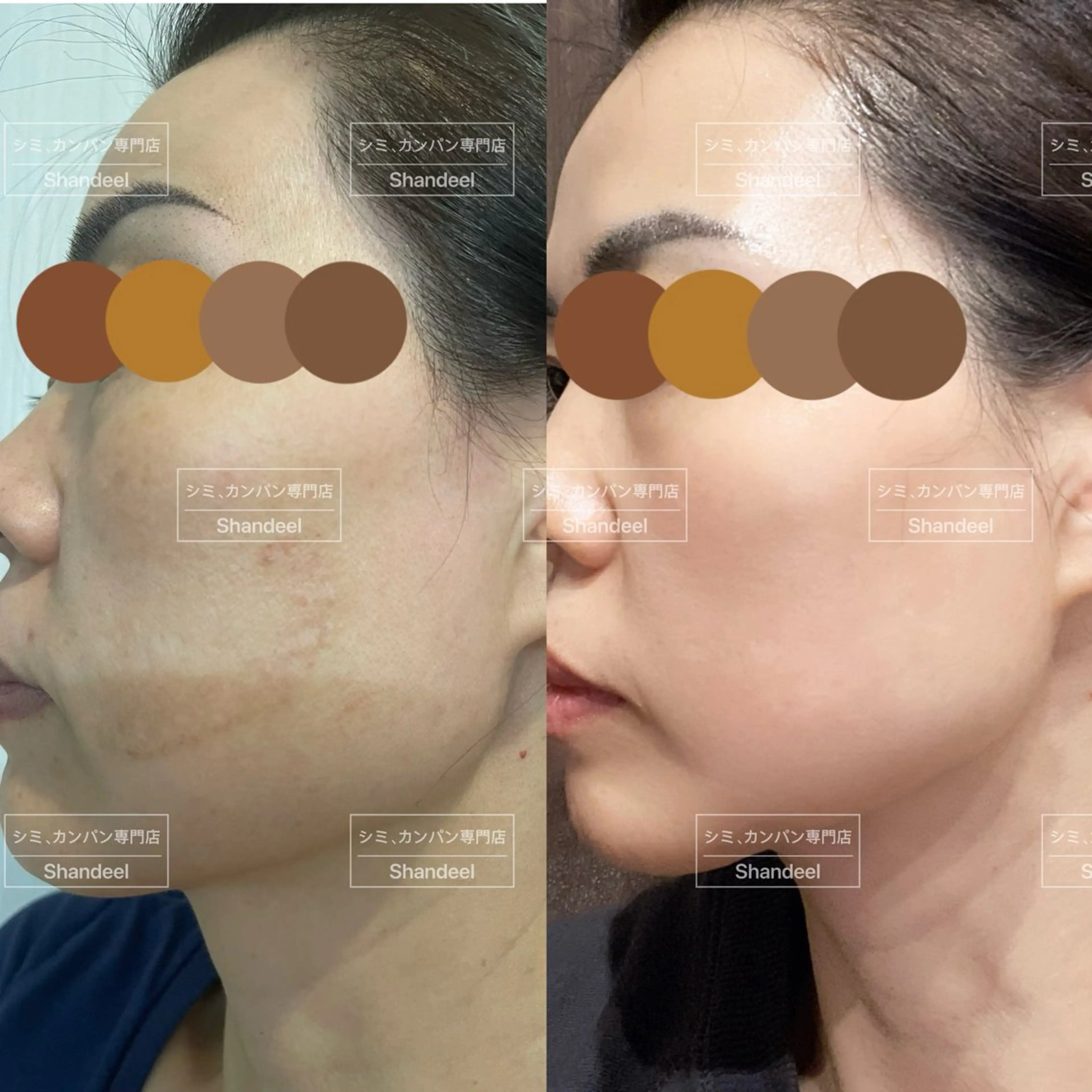 エステ リラク 肌管理専門店 Shandeelのエステ・リラクイメージ