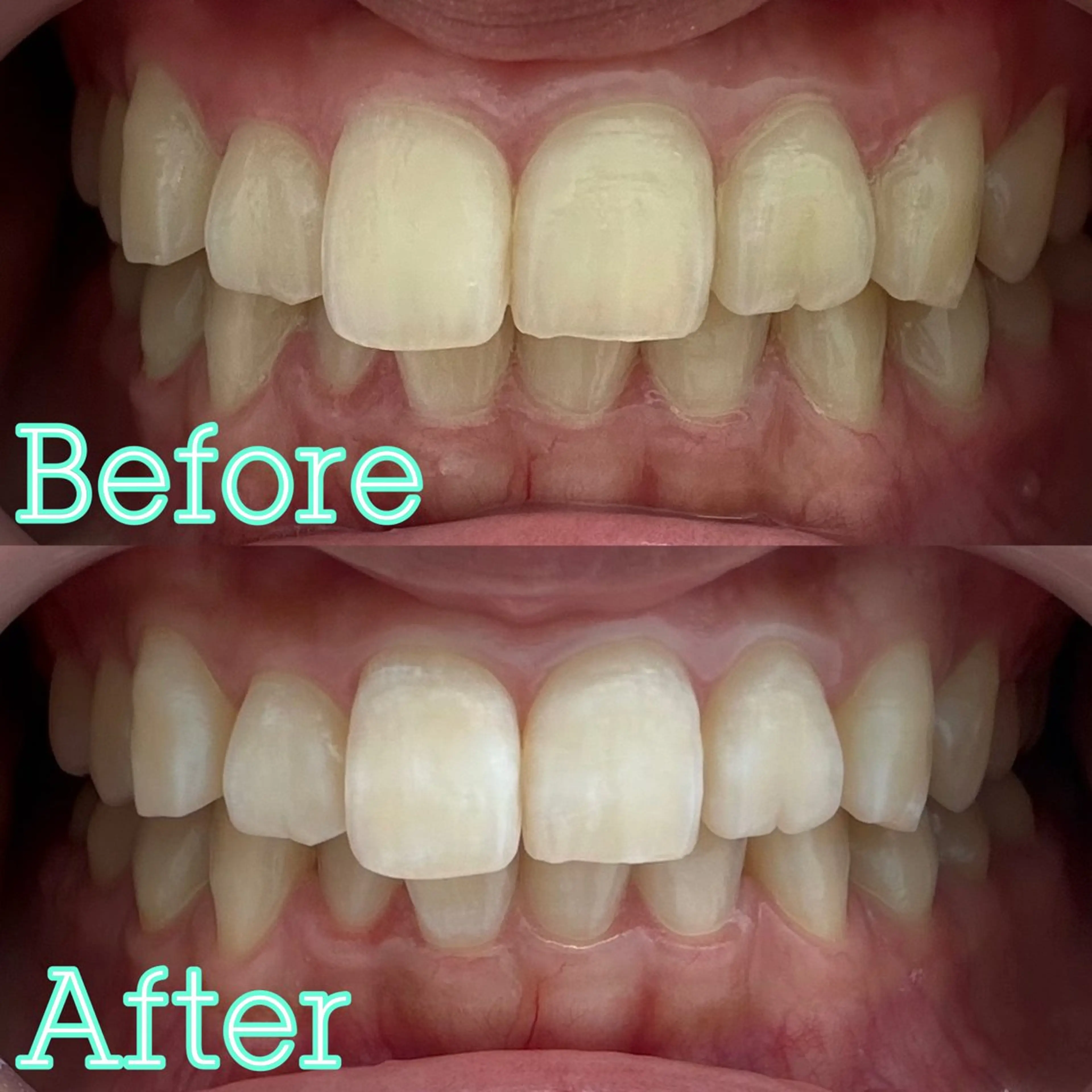 歯のホワイトニング専門店 MIGAQ 京都四条大宮店所属・佐藤 未来の眉毛・アイブロウイメージ