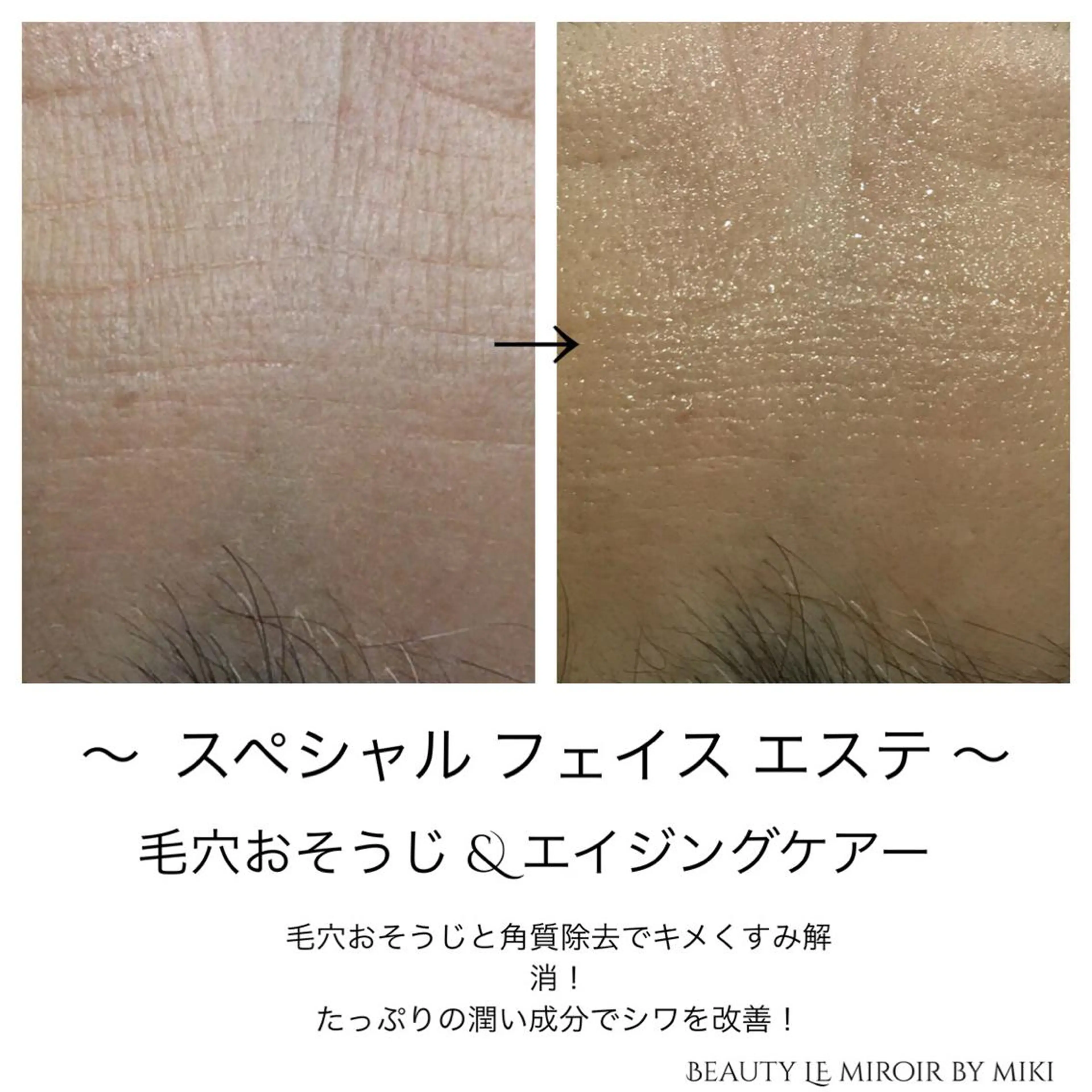 マツエク・マツパ ビューティー ミロワールのエステ・リラクイメージ